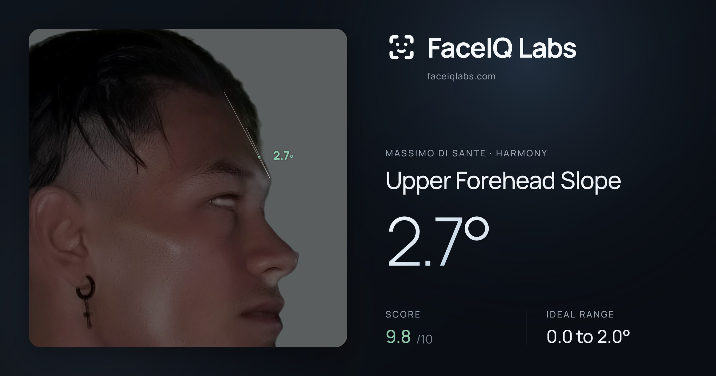 Massimo di Sante Upper Forehead Slope: 2.7°, drawn on the photo