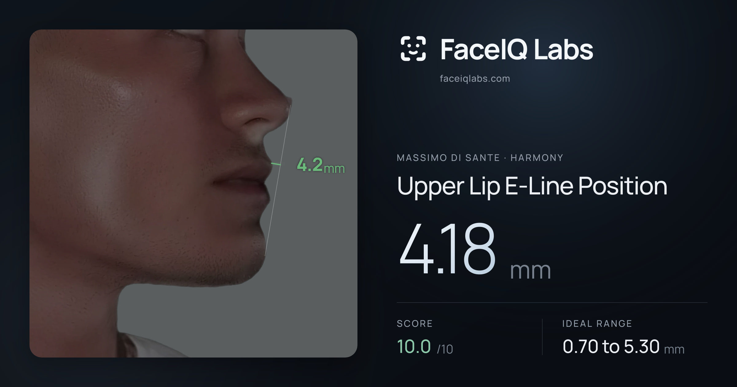 Massimo di Sante Upper Lip E-Line Position: 4.18mm, drawn on the photo