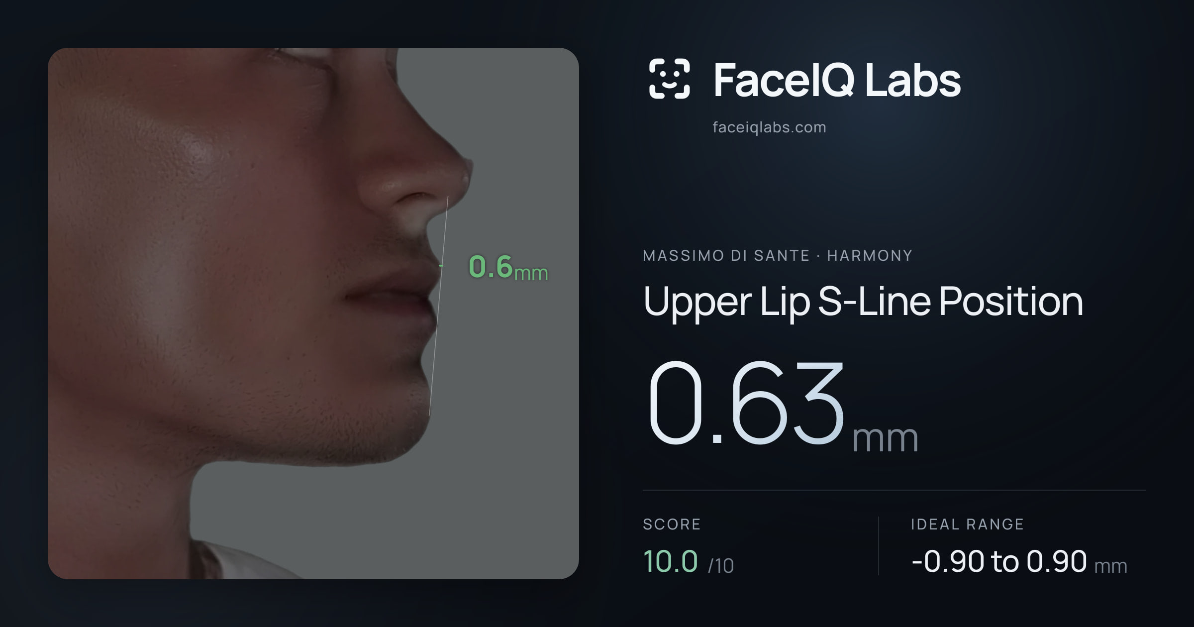 Massimo di Sante Upper Lip S-Line Position: 0.63mm, drawn on the photo