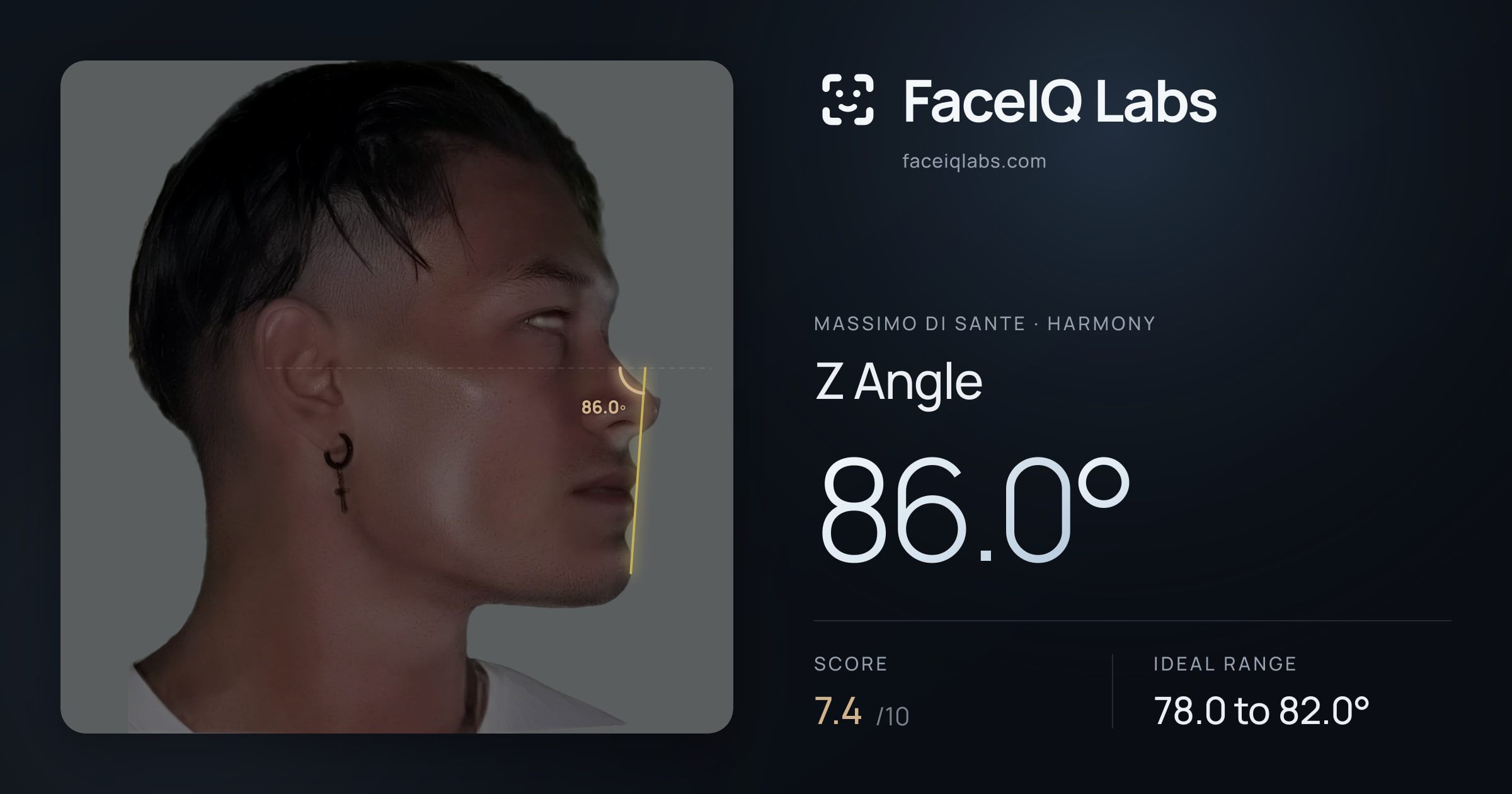 Massimo di Sante Z Angle: 86.0°, drawn on the photo