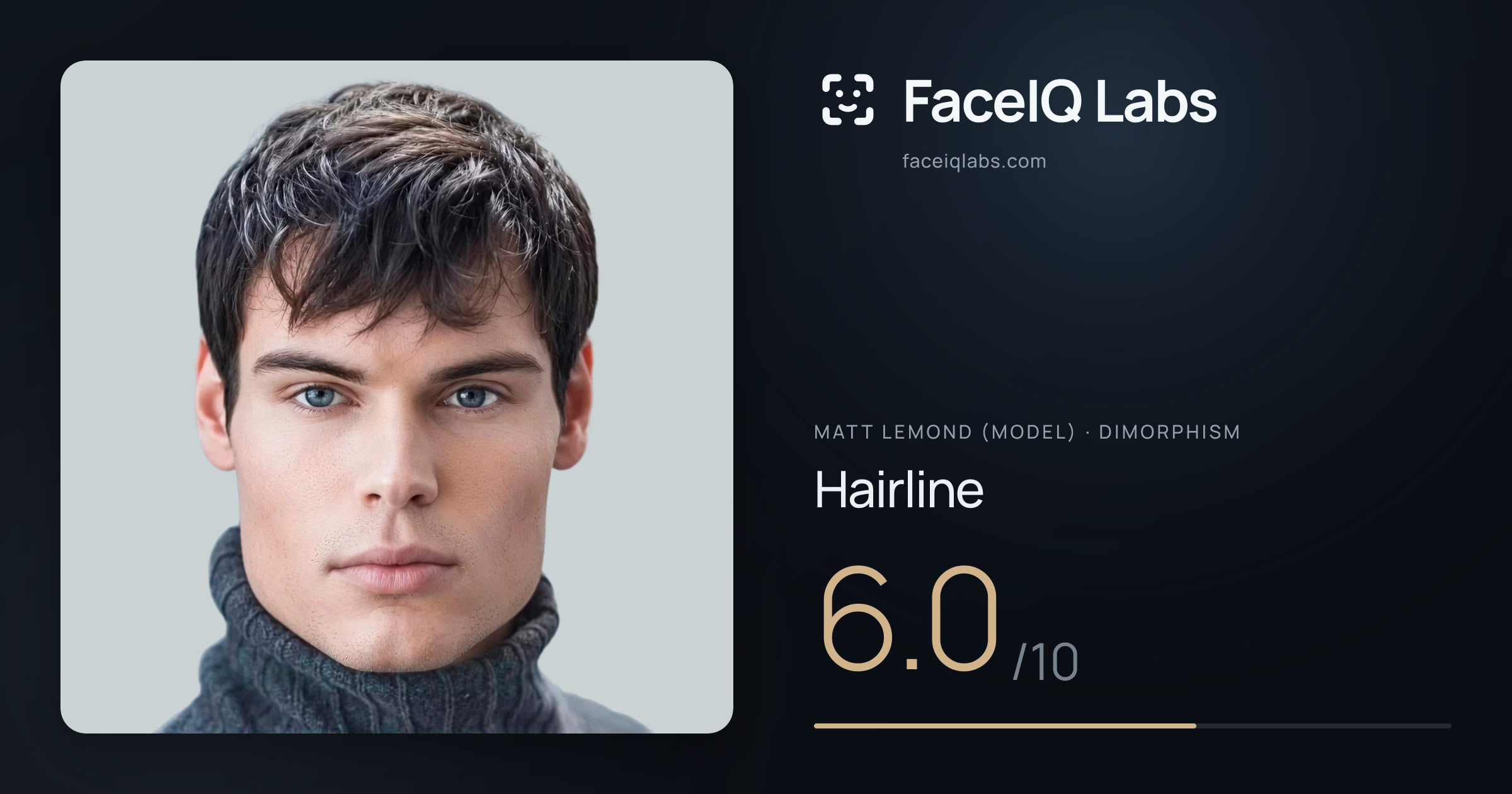 Matt Lemond (Model) Hairline: 6.0/10, drawn on the photo