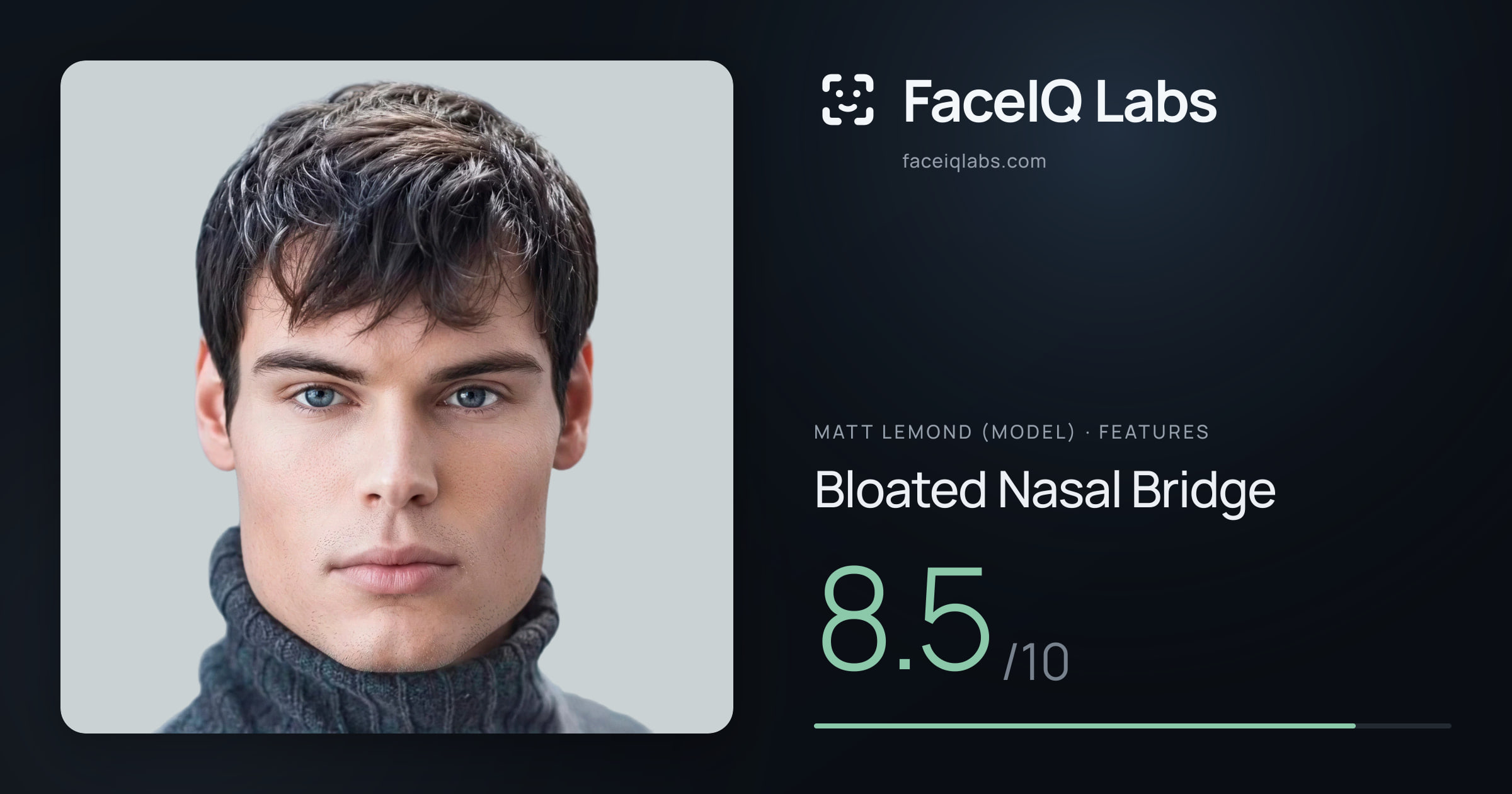 Matt Lemond (Model) Bloated Nasal Bridge: 8.5/10, drawn on the photo