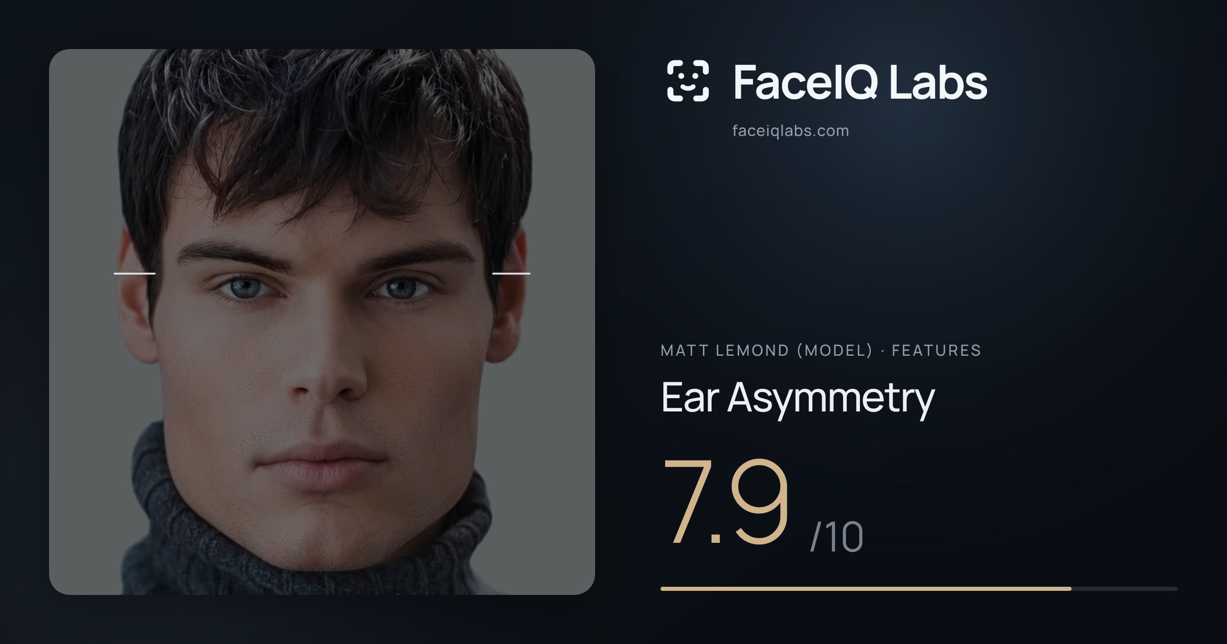 Matt Lemond (Model) Ear Asymmetry: 7.9/10, drawn on the photo