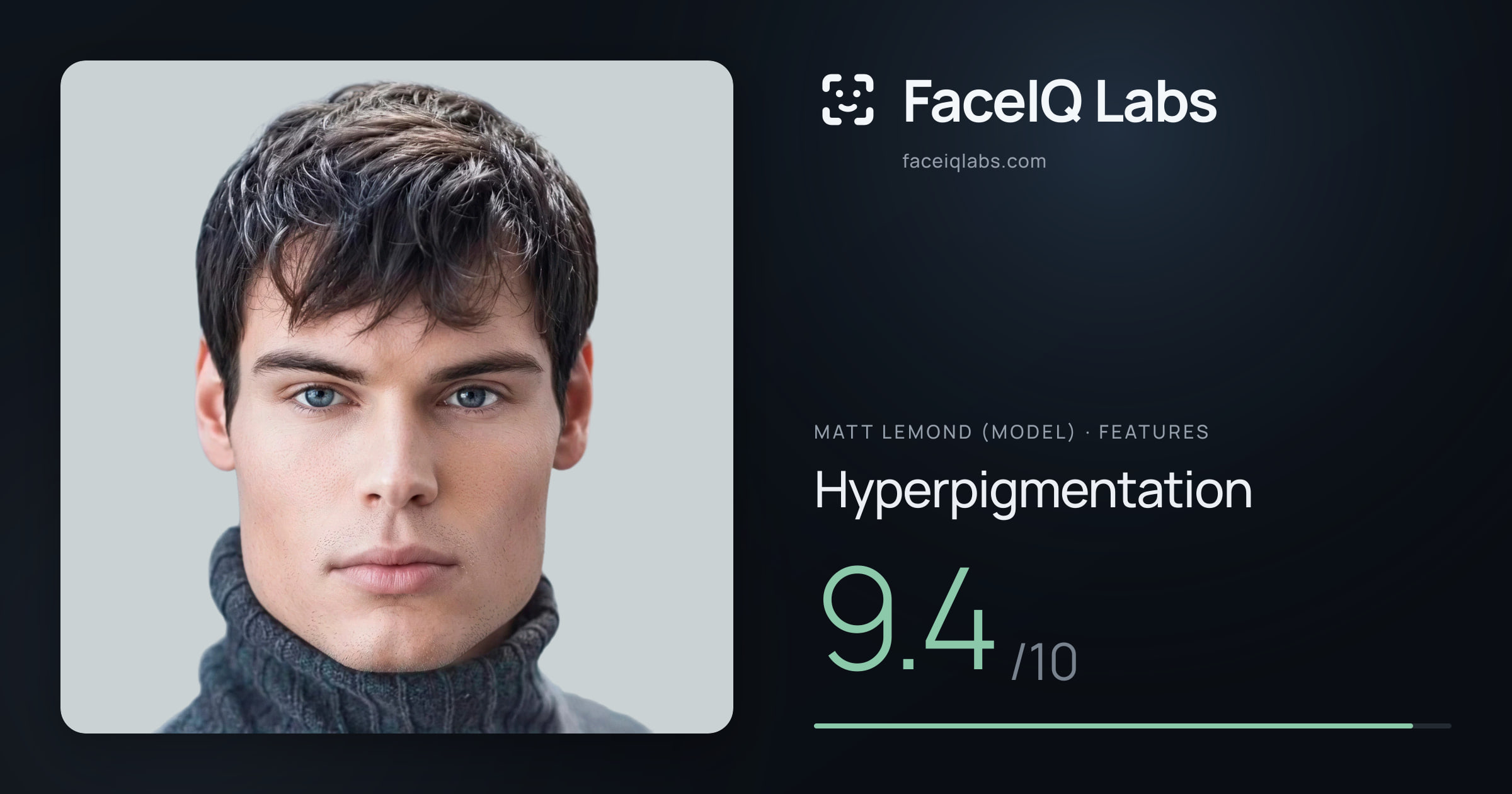 Matt Lemond (Model) Hyperpigmentation: 9.4/10, drawn on the photo