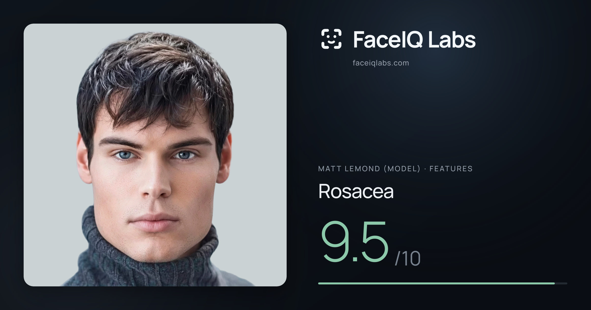 Matt Lemond (Model) Rosacea: 9.5/10, drawn on the photo