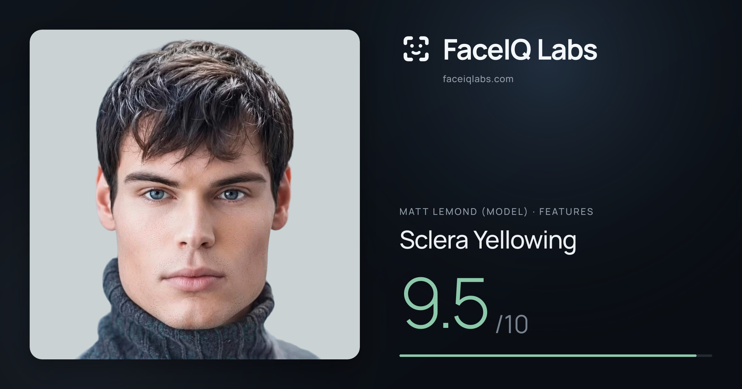 Matt Lemond (Model) Sclera Yellowing: 9.5/10, drawn on the photo