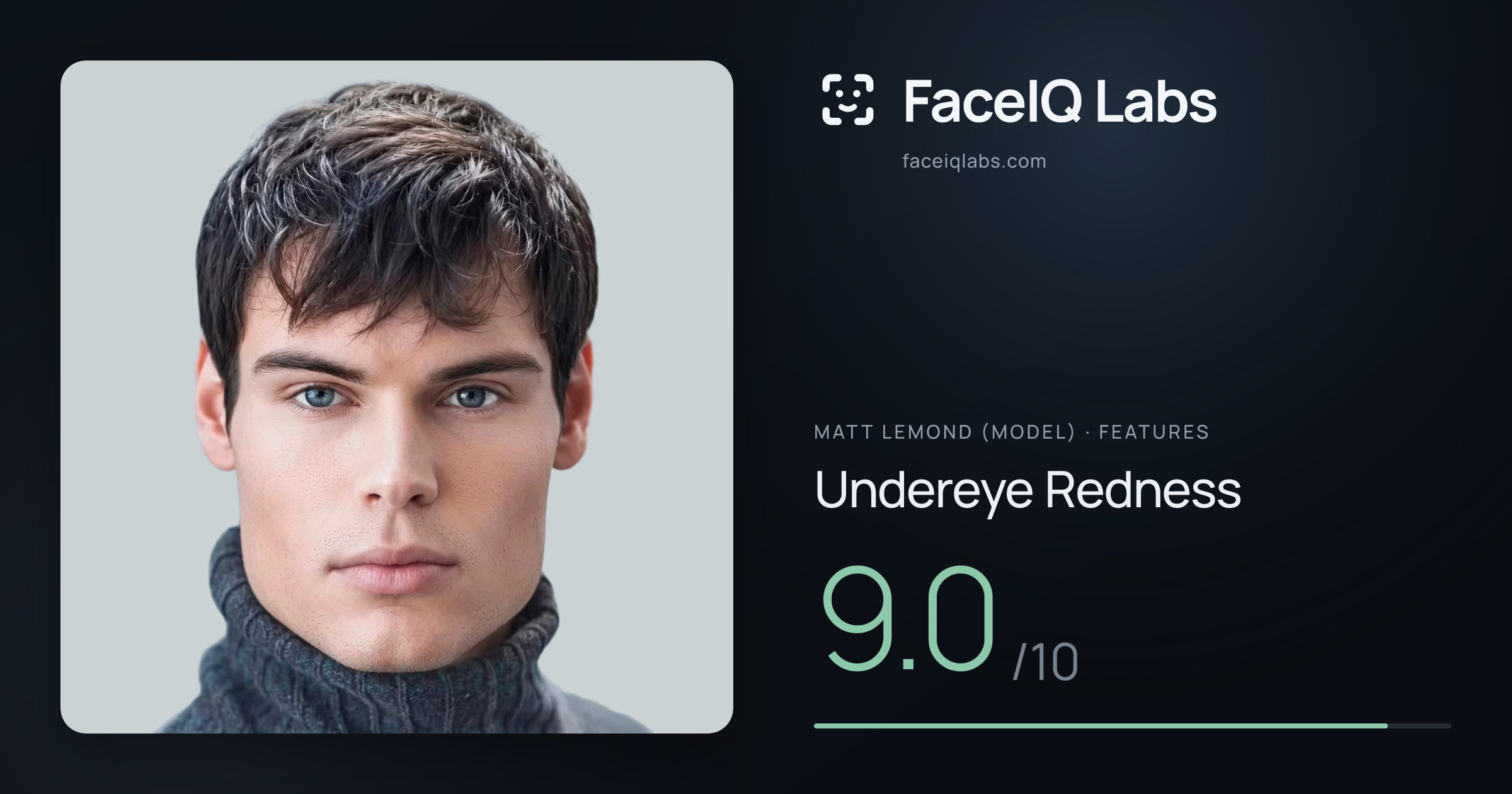 Matt Lemond (Model) Undereye Redness: 9.0/10, drawn on the photo