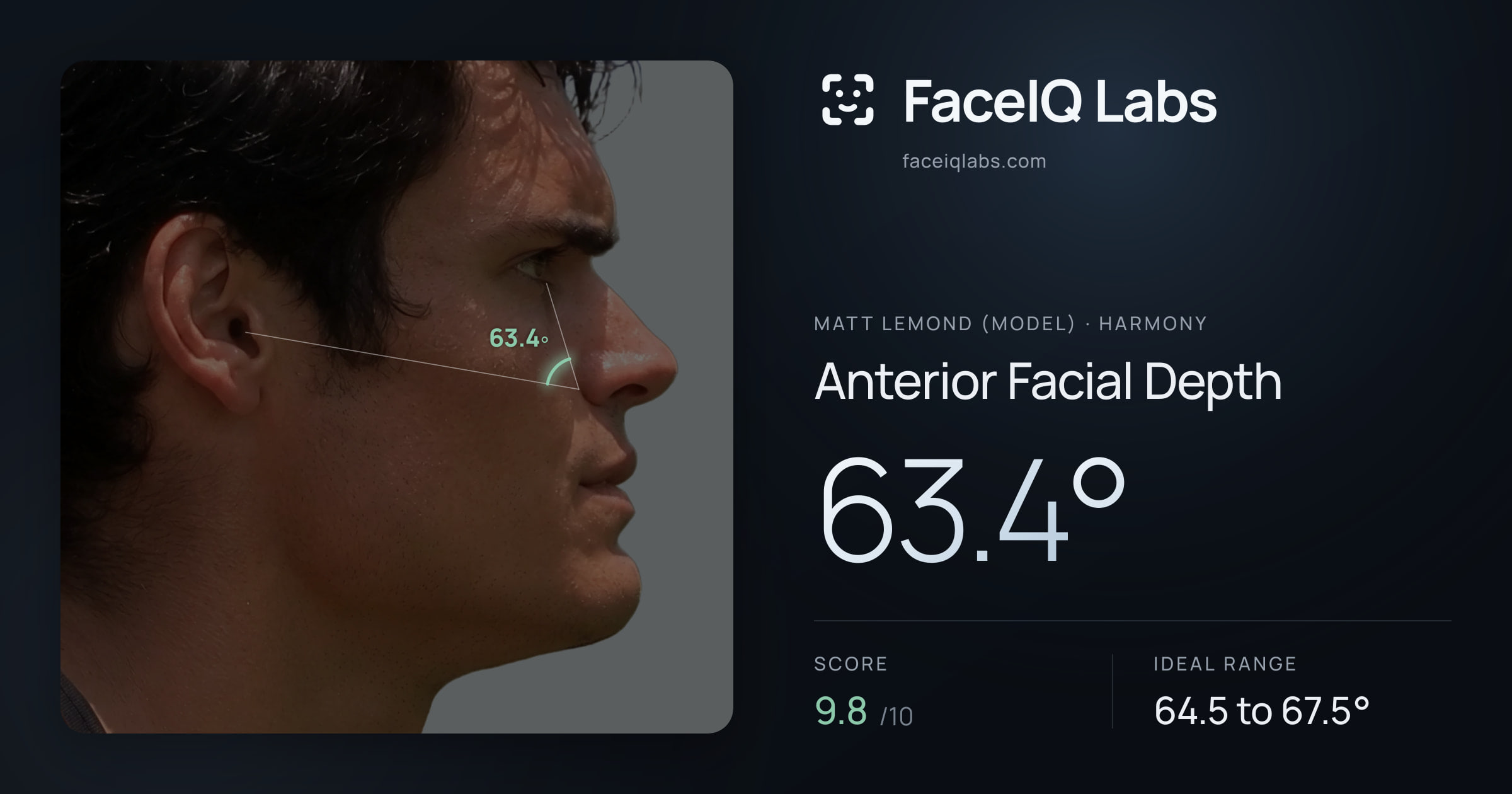 Matt Lemond (Model) Anterior Facial Depth: 63.4°, drawn on the photo