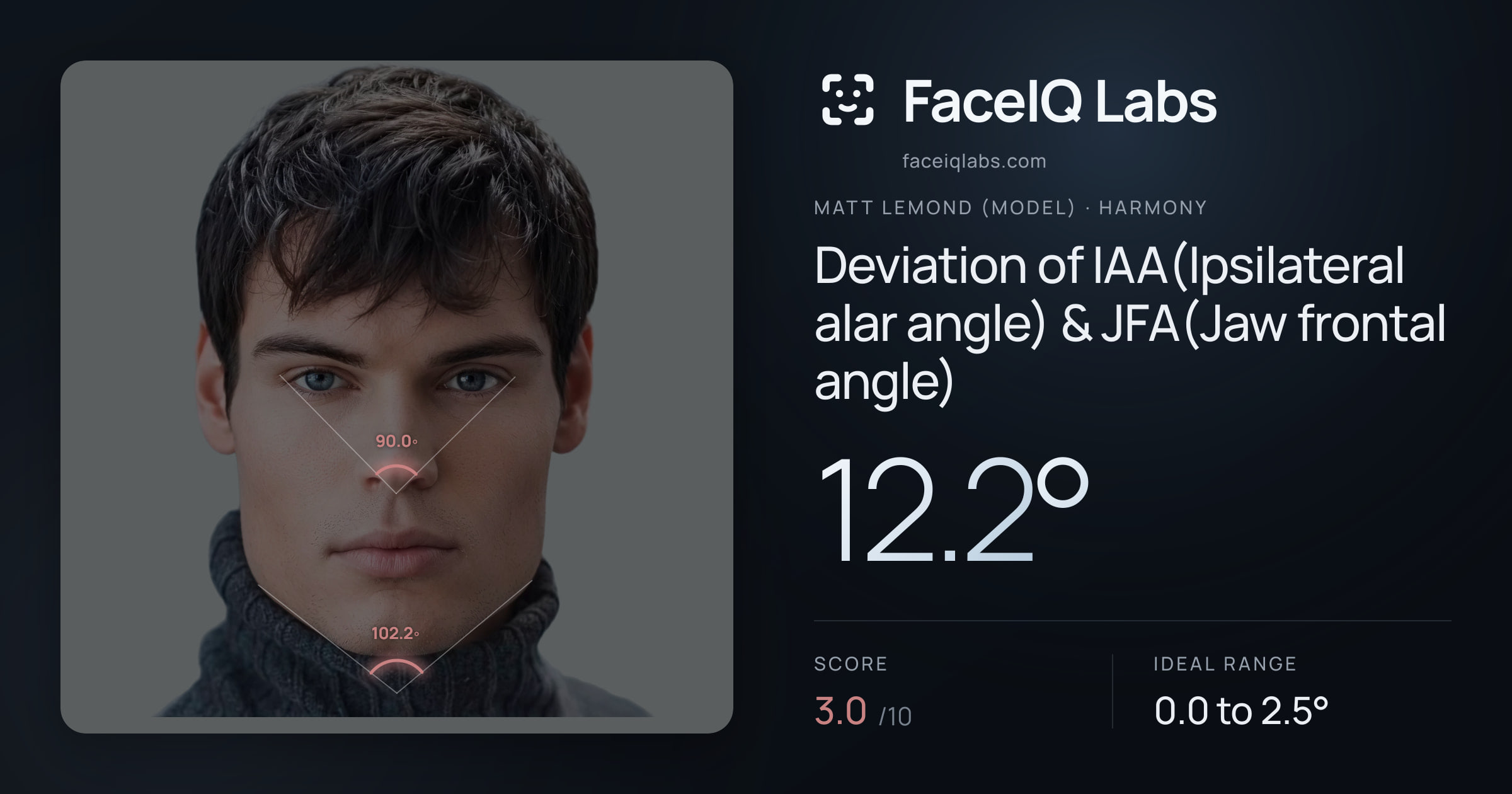 Matt Lemond (Model) Deviation of IAA(Ipsilateral alar angle) & JFA(Jaw frontal angle): 12.2°, drawn on the photo
