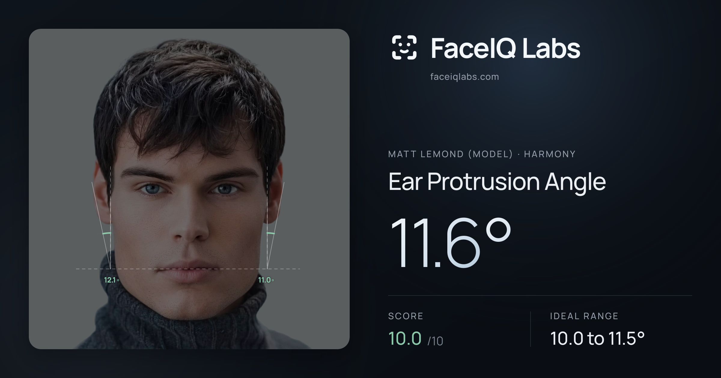 Matt Lemond (Model) Ear Protrusion Angle: 11.6°, drawn on the photo