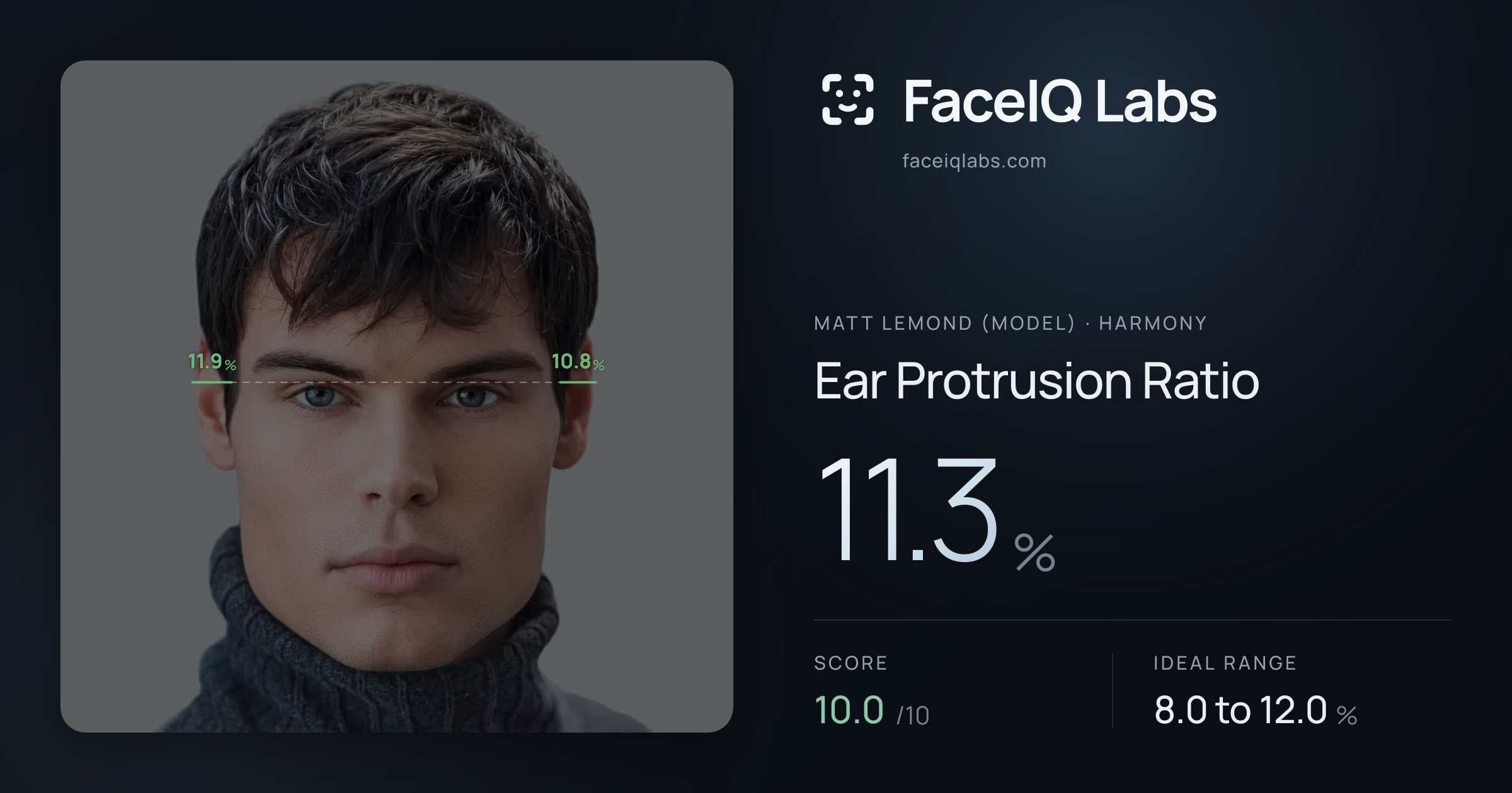 Matt Lemond (Model) Ear Protrusion Ratio: 11.3%, drawn on the photo