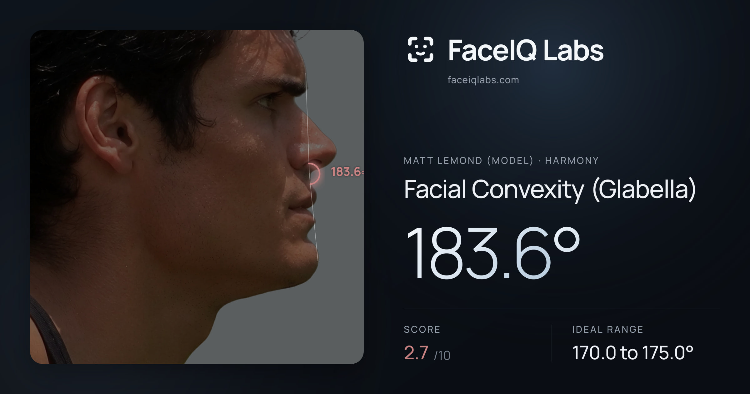 Matt Lemond (Model) Facial Convexity (Glabella): 183.6°, drawn on the photo