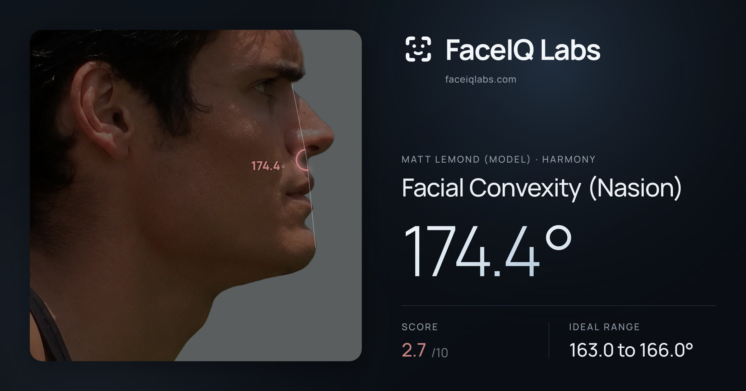 Matt Lemond (Model) Facial Convexity (Nasion): 174.4°, drawn on the photo