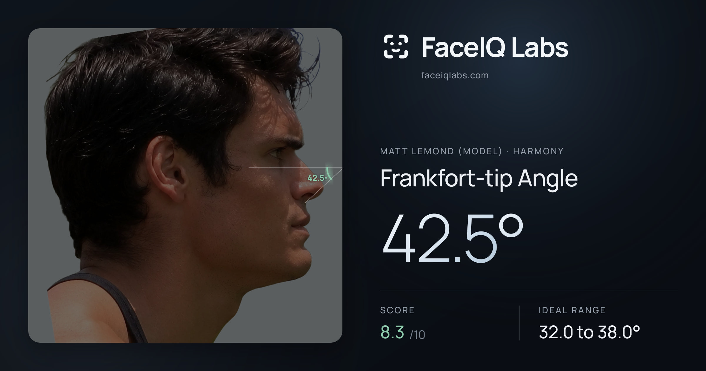 Matt Lemond (Model) Frankfort-tip Angle: 42.5°, drawn on the photo