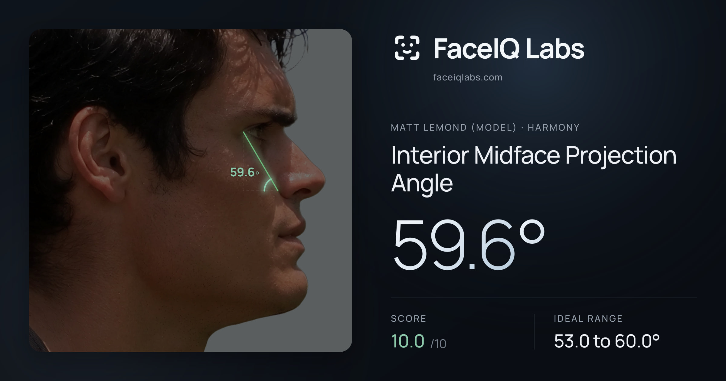 Matt Lemond (Model) Interior Midface Projection Angle: 59.6°, drawn on the photo
