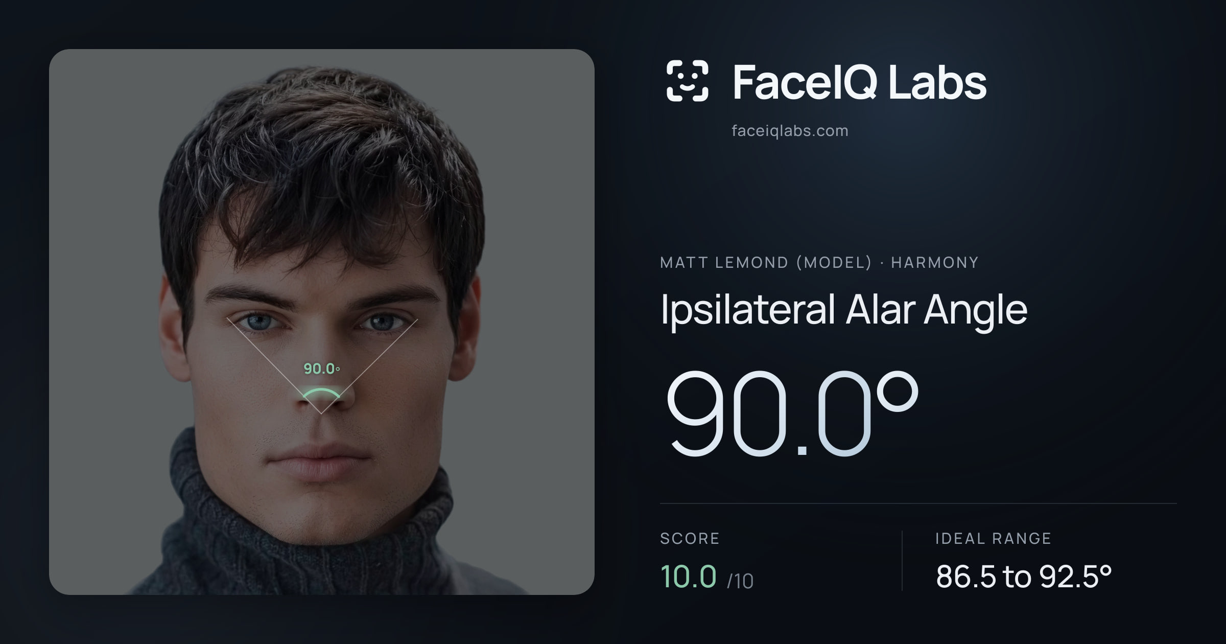 Matt Lemond (Model) Ipsilateral Alar Angle: 90.0°, drawn on the photo