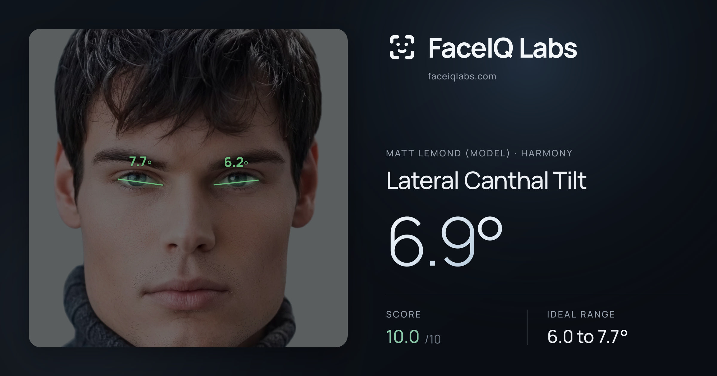 Matt Lemond (Model) Lateral Canthal Tilt: 6.9°, drawn on the photo