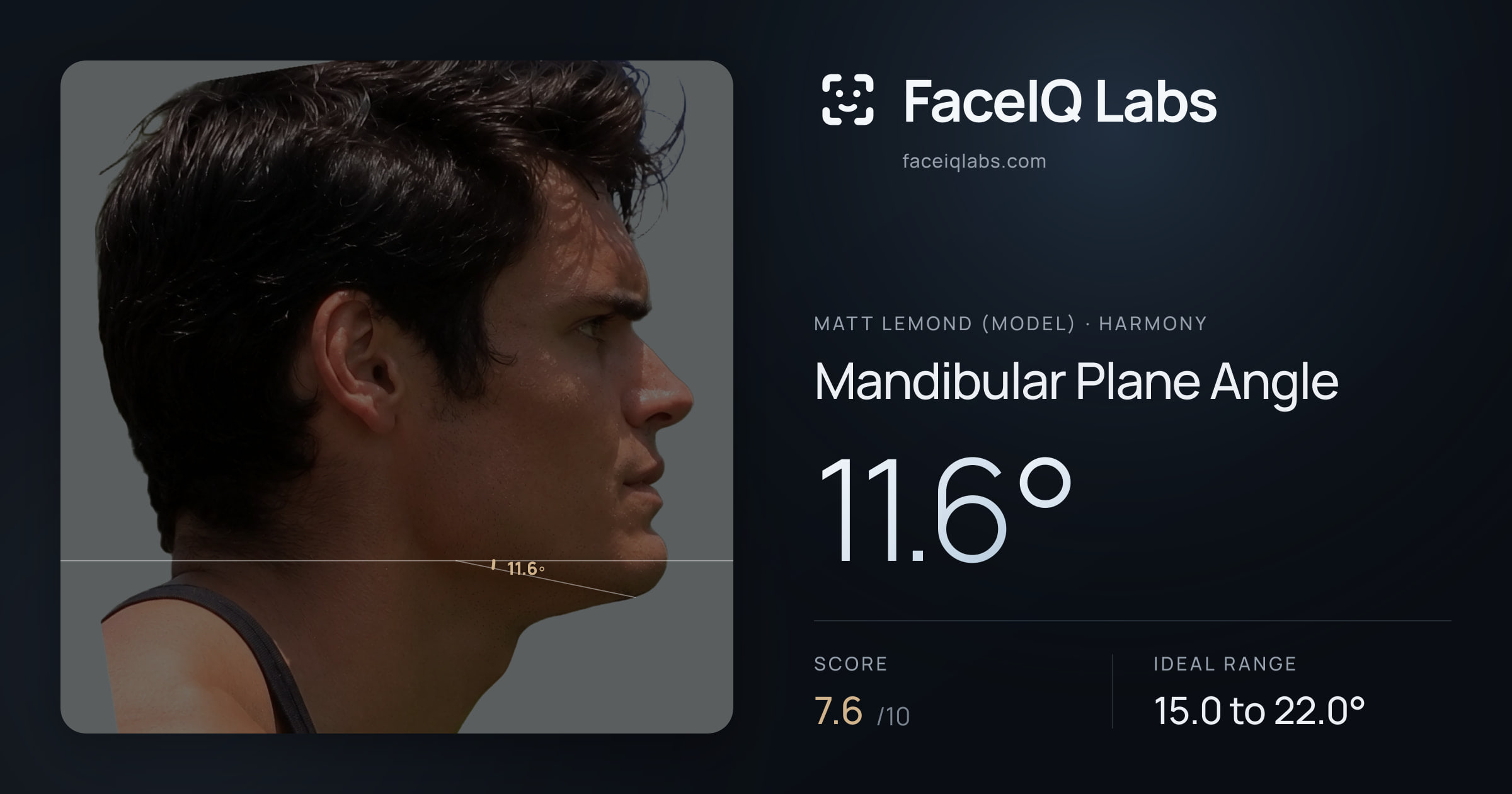 Matt Lemond (Model) Mandibular Plane Angle: 11.6°, drawn on the photo