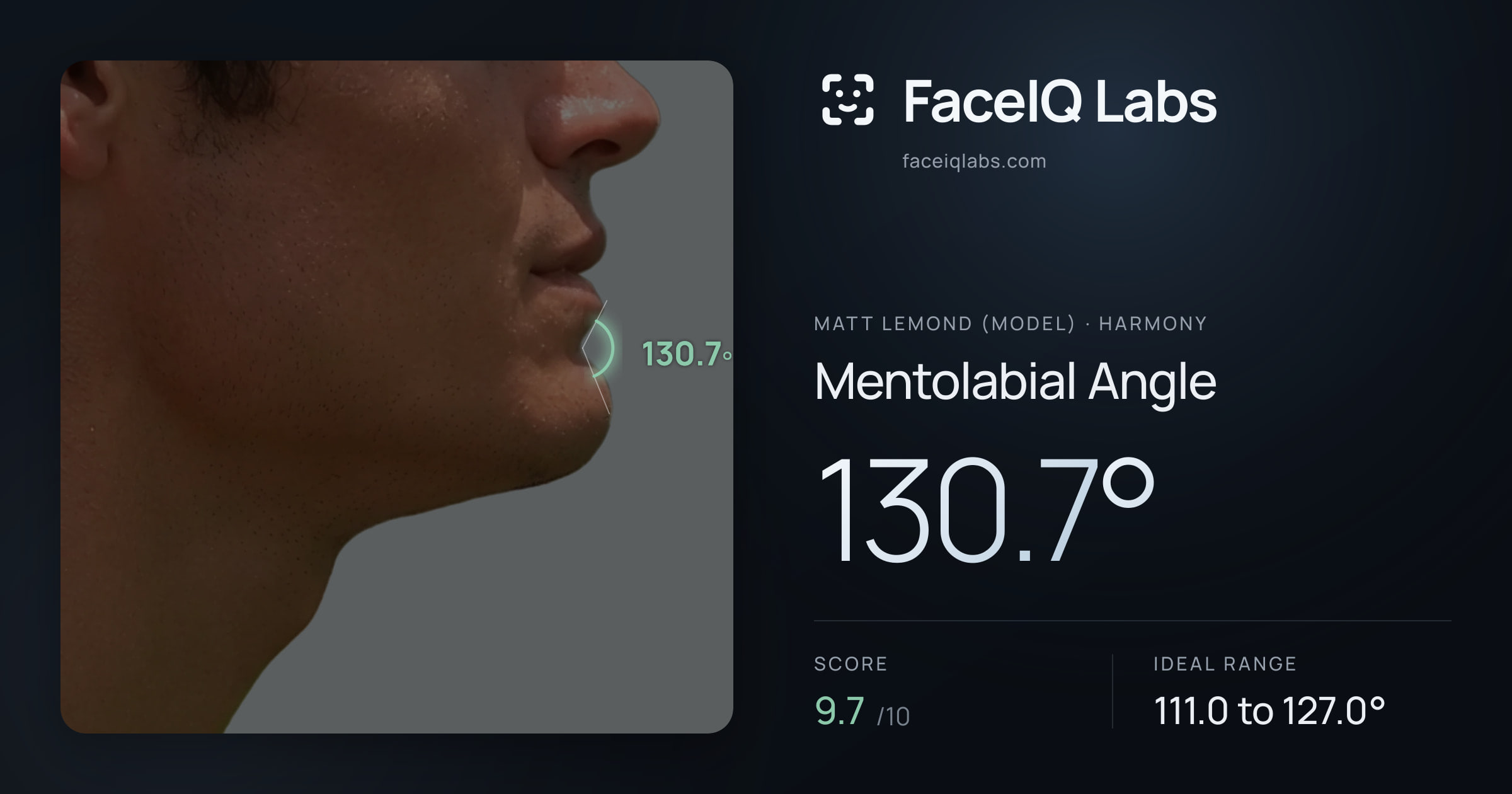 Matt Lemond (Model) Mentolabial Angle: 130.7°, drawn on the photo