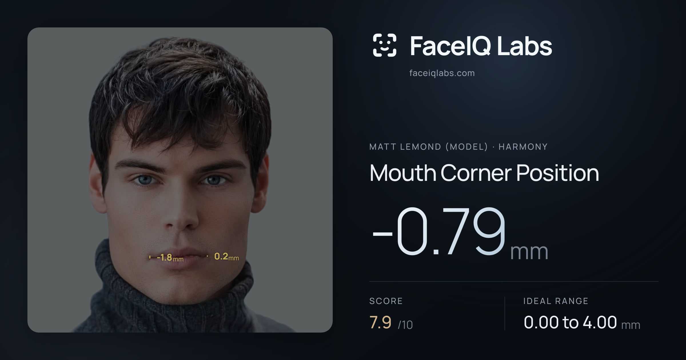 Matt Lemond (Model) Mouth Corner Position: -0.79mm, drawn on the photo