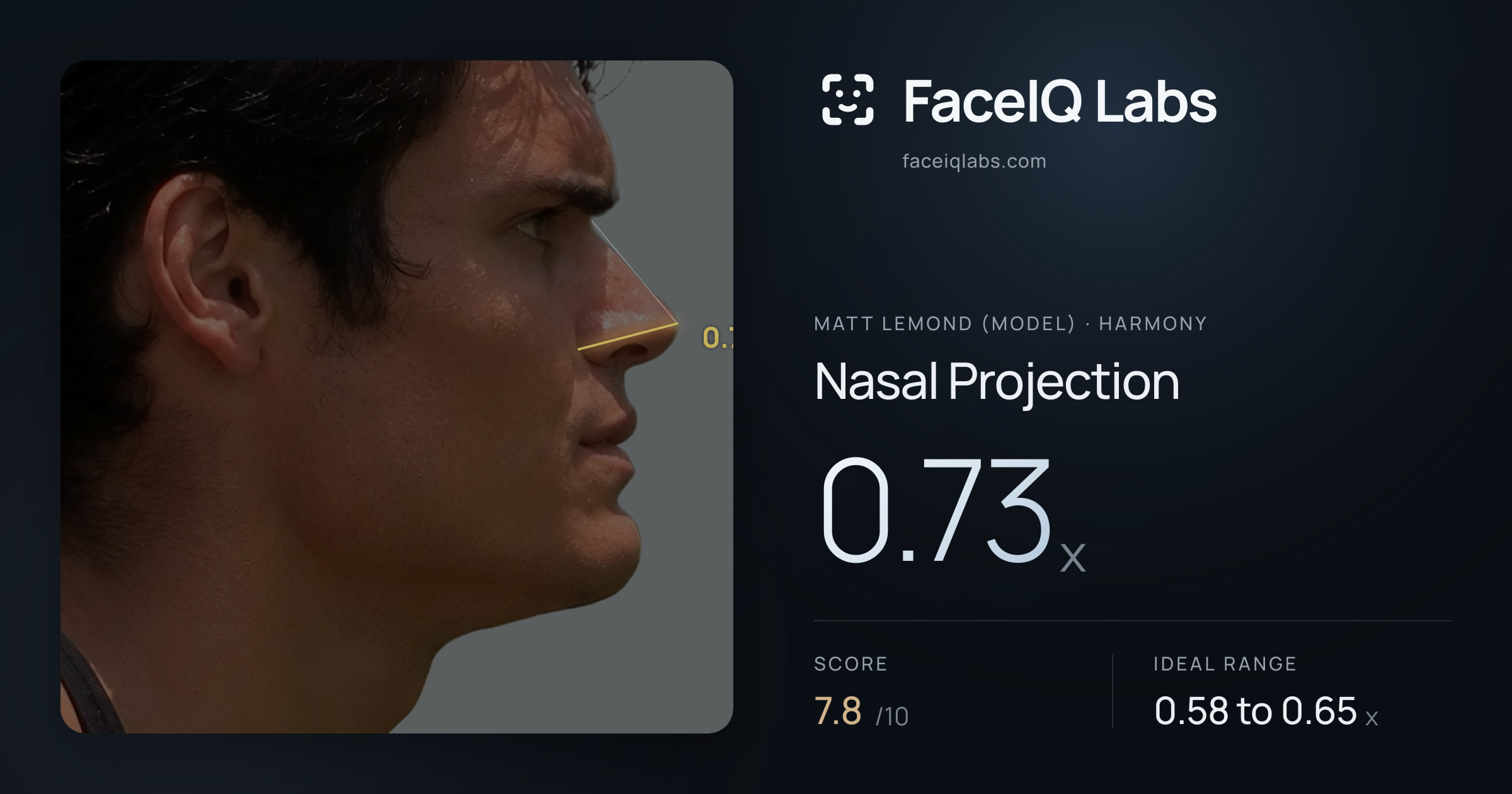Matt Lemond (Model) Nasal Projection: 0.73x, drawn on the photo