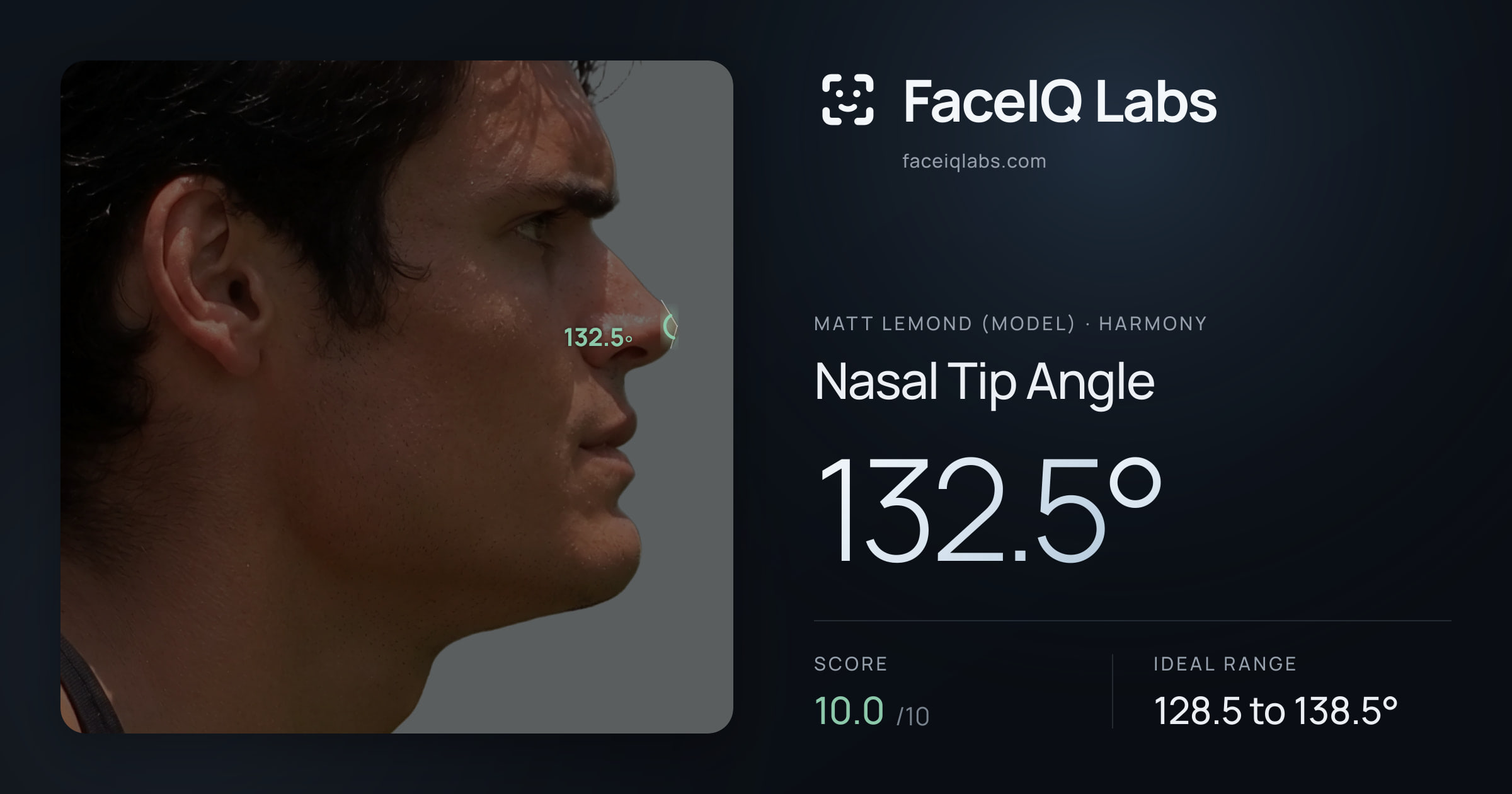 Matt Lemond (Model) Nasal Tip Angle: 132.5°, drawn on the photo
