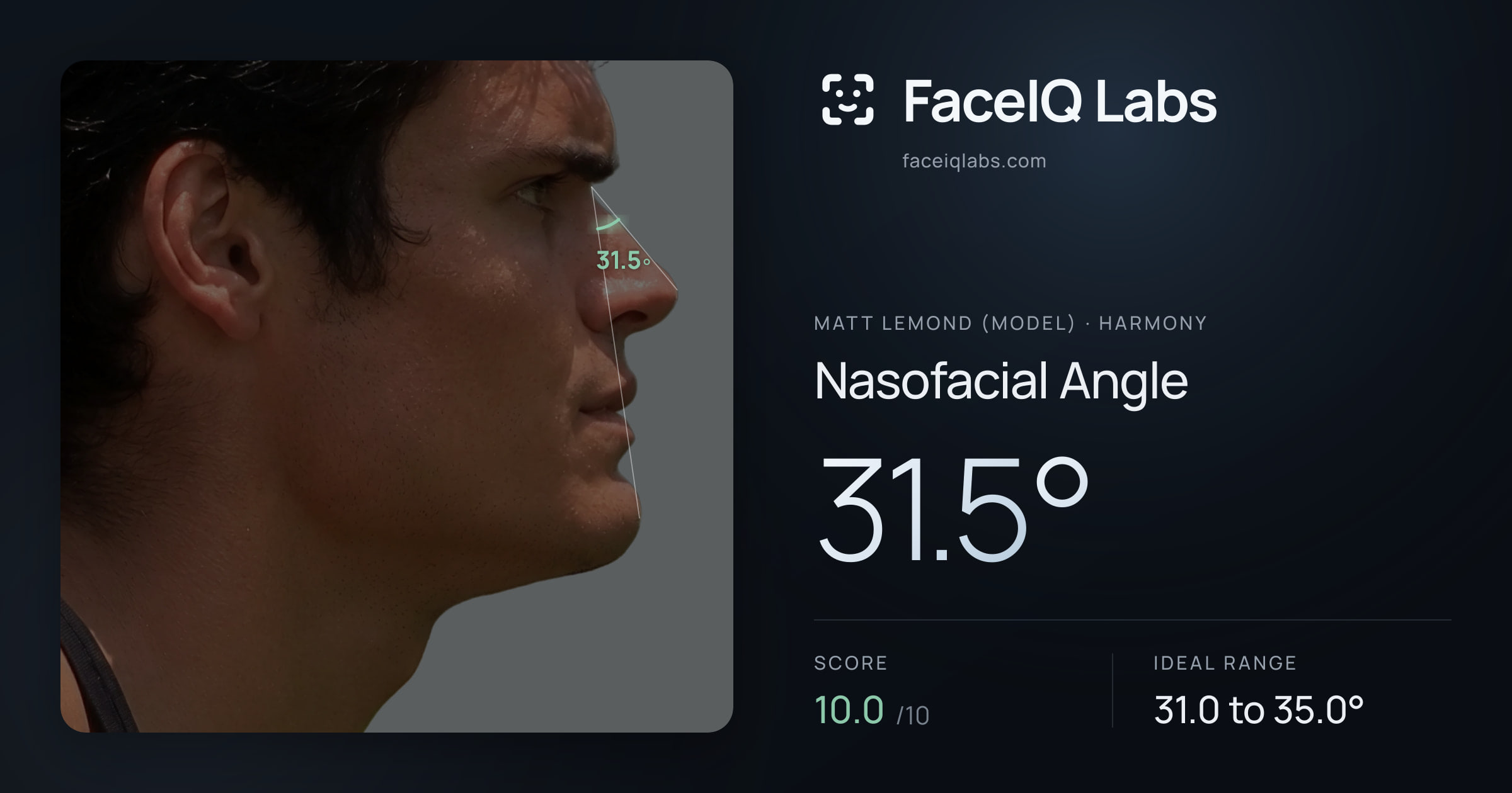 Matt Lemond (Model) Nasofacial Angle: 31.5°, drawn on the photo