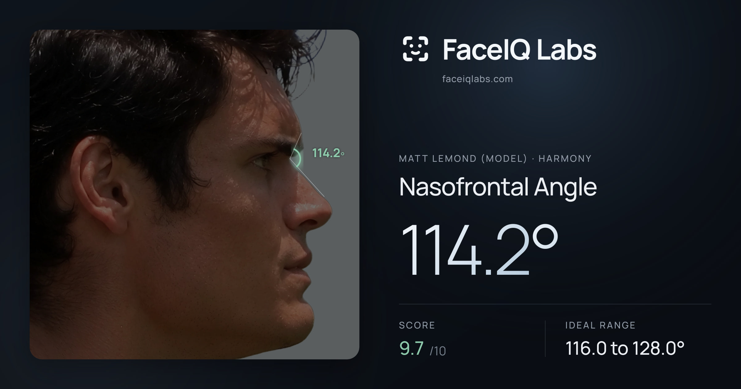 Matt Lemond (Model) Nasofrontal Angle: 114.2°, drawn on the photo