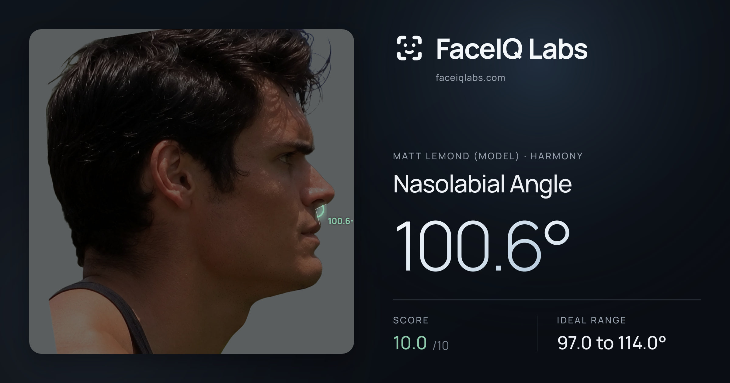 Matt Lemond (Model) Nasolabial Angle: 100.6°, drawn on the photo