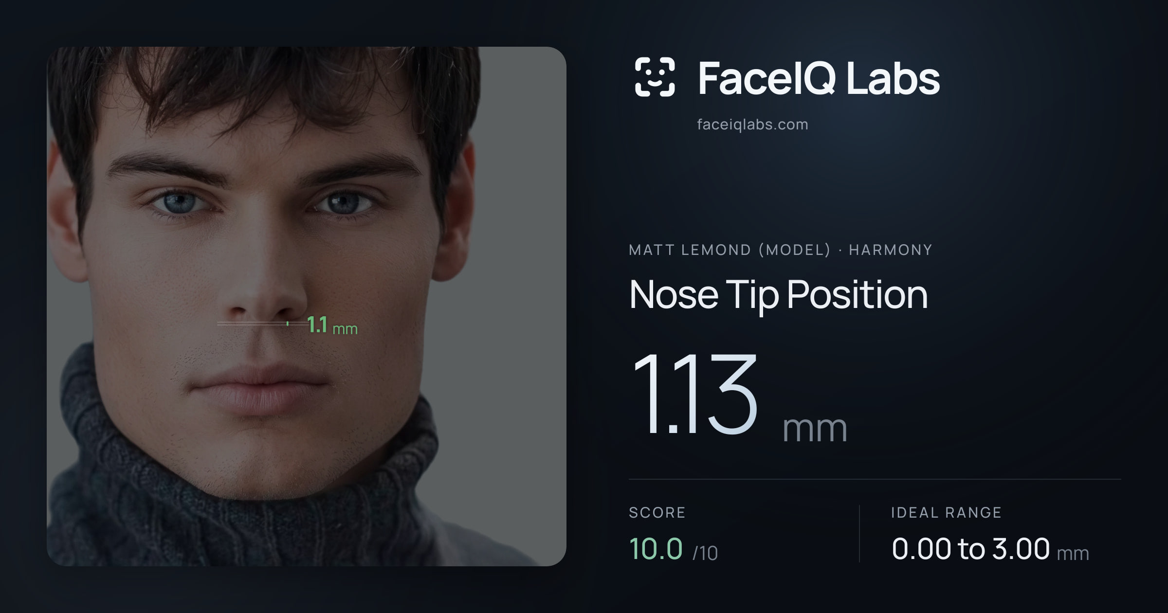 Matt Lemond (Model) Nose Tip Position: 1.13mm, drawn on the photo