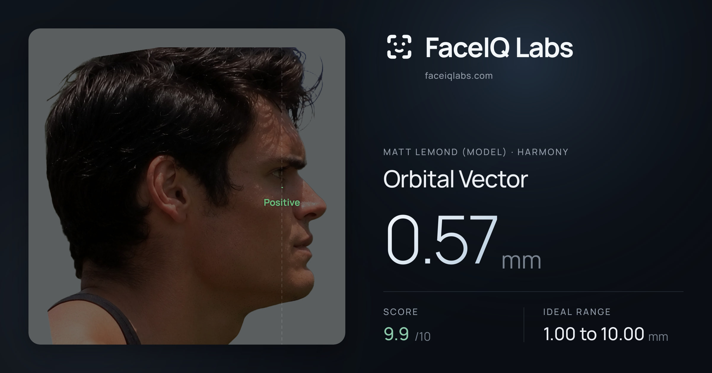 Matt Lemond (Model) Orbital Vector: 0.57mm, drawn on the photo