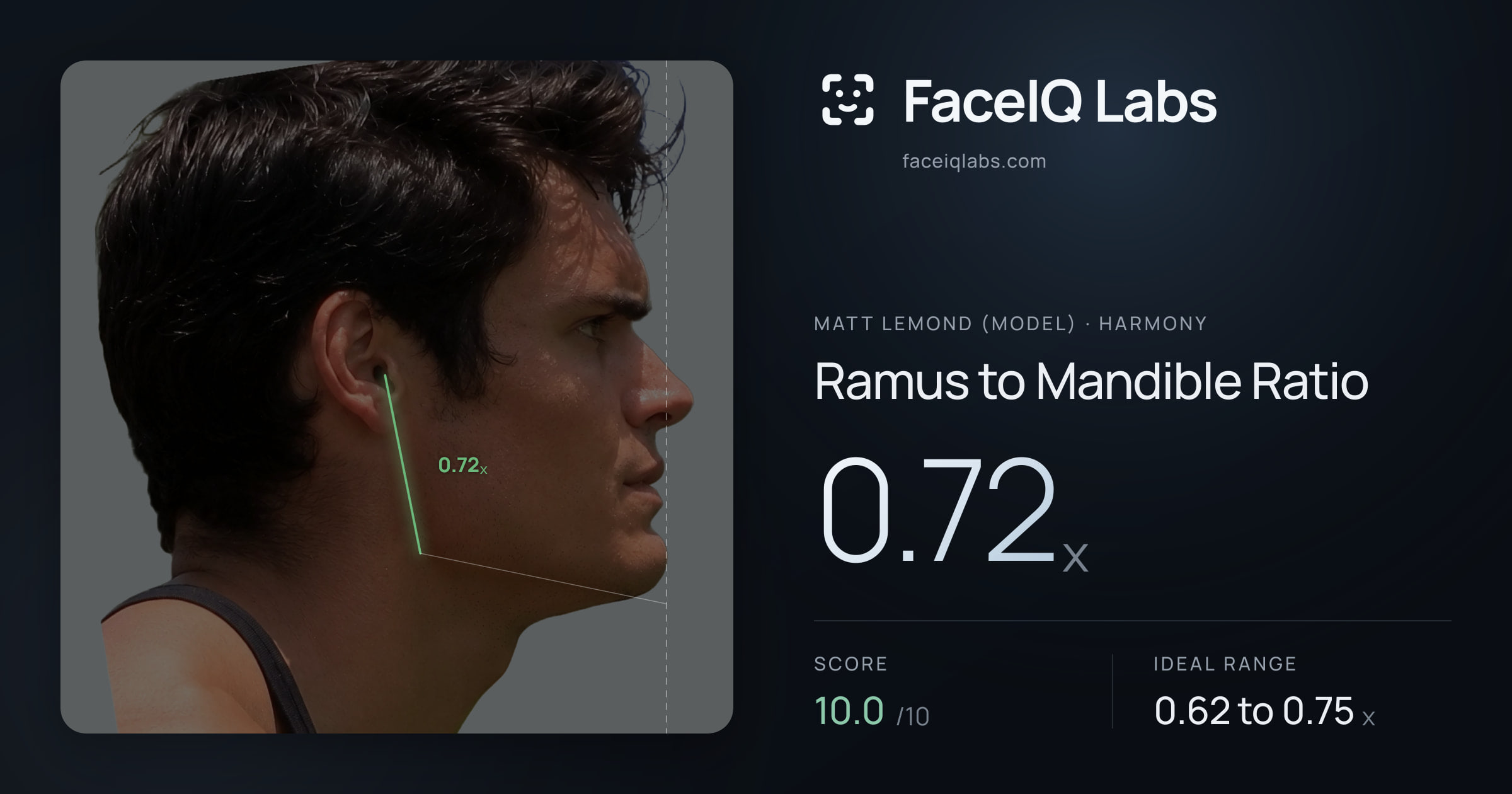Matt Lemond (Model) Ramus to Mandible Ratio: 0.72x, drawn on the photo