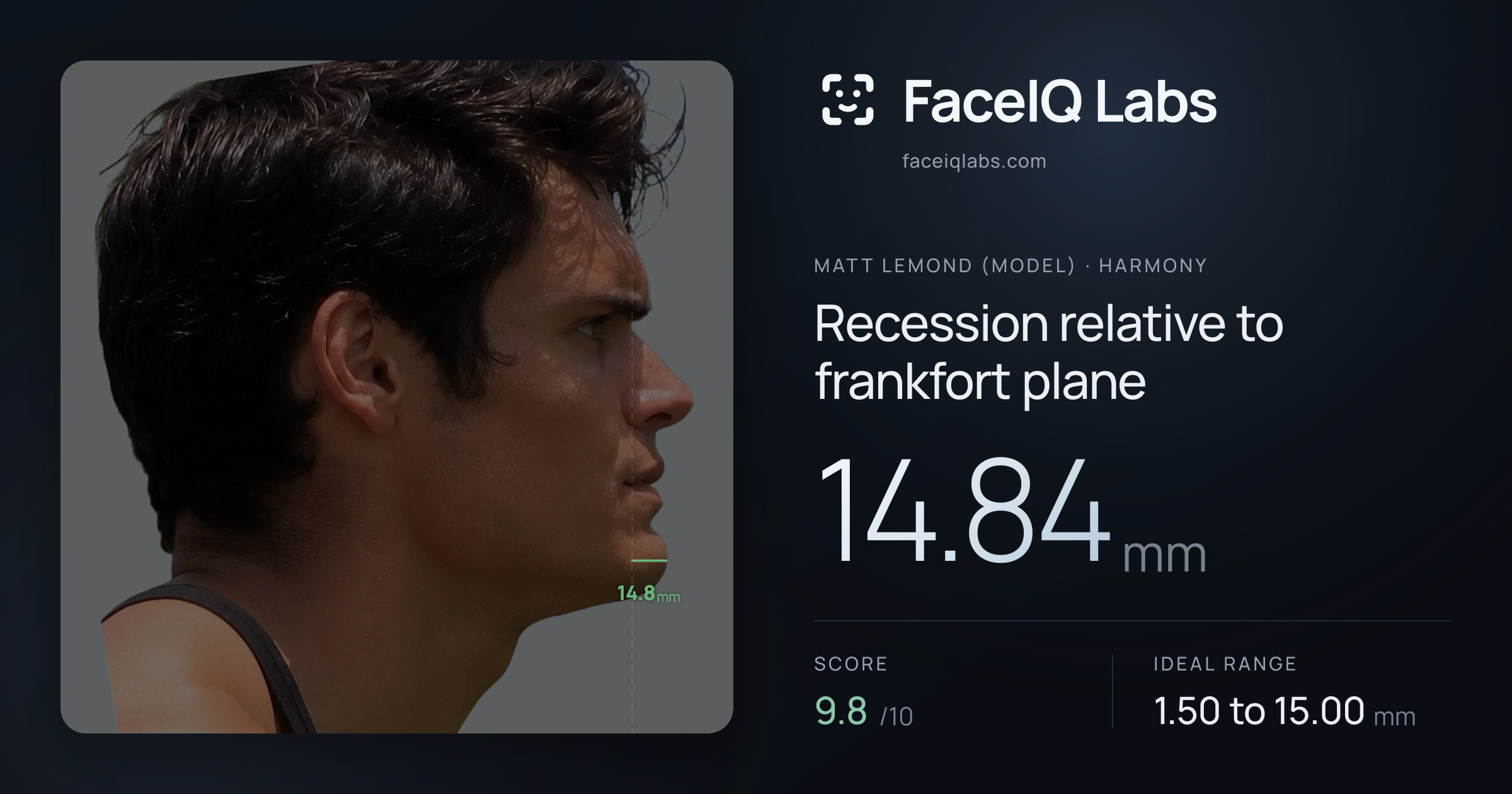 Matt Lemond (Model) Recession relative to frankfort plane: 14.84mm, drawn on the photo