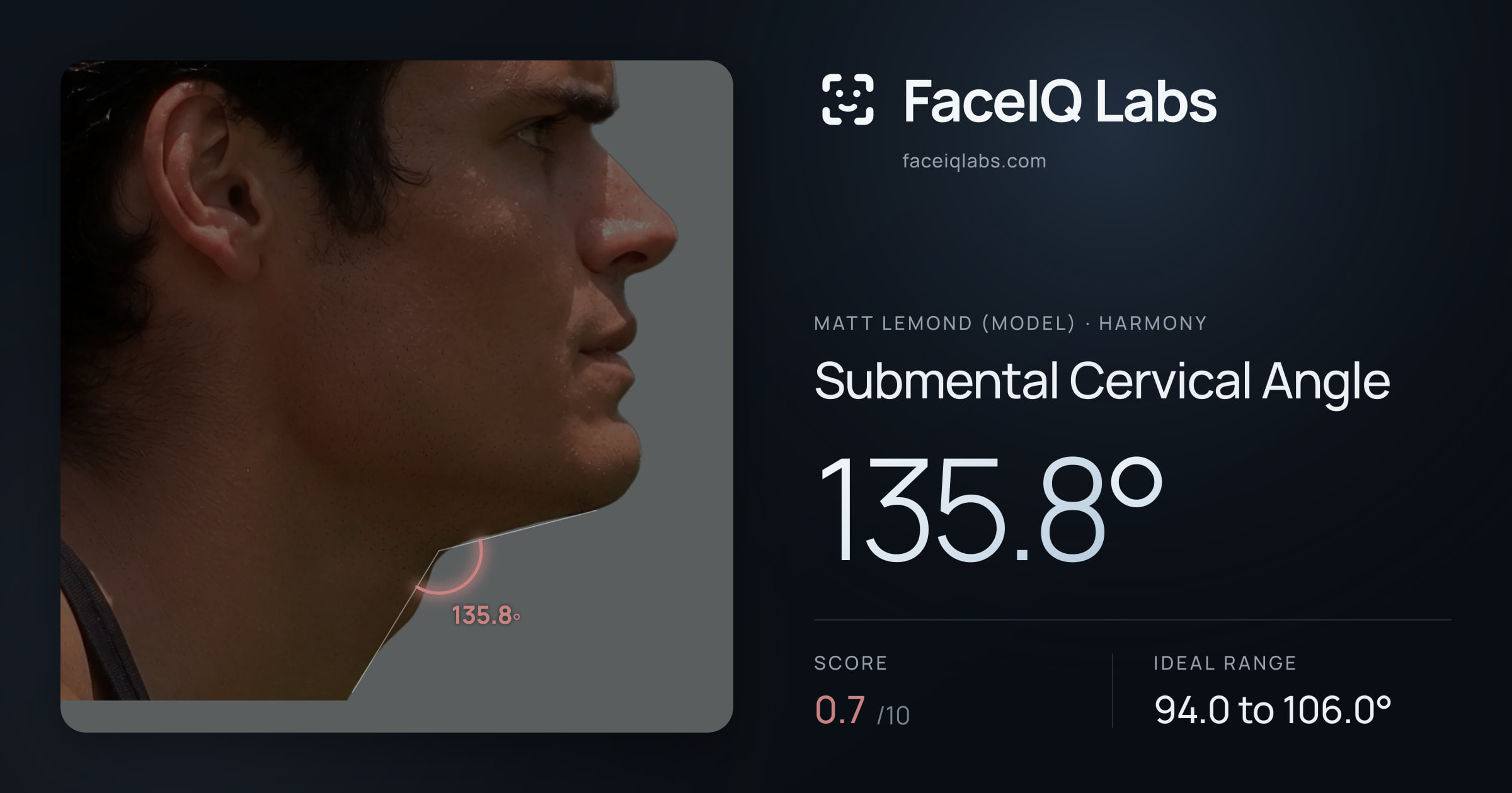 Matt Lemond (Model) Submental Cervical Angle: 135.8°, drawn on the photo