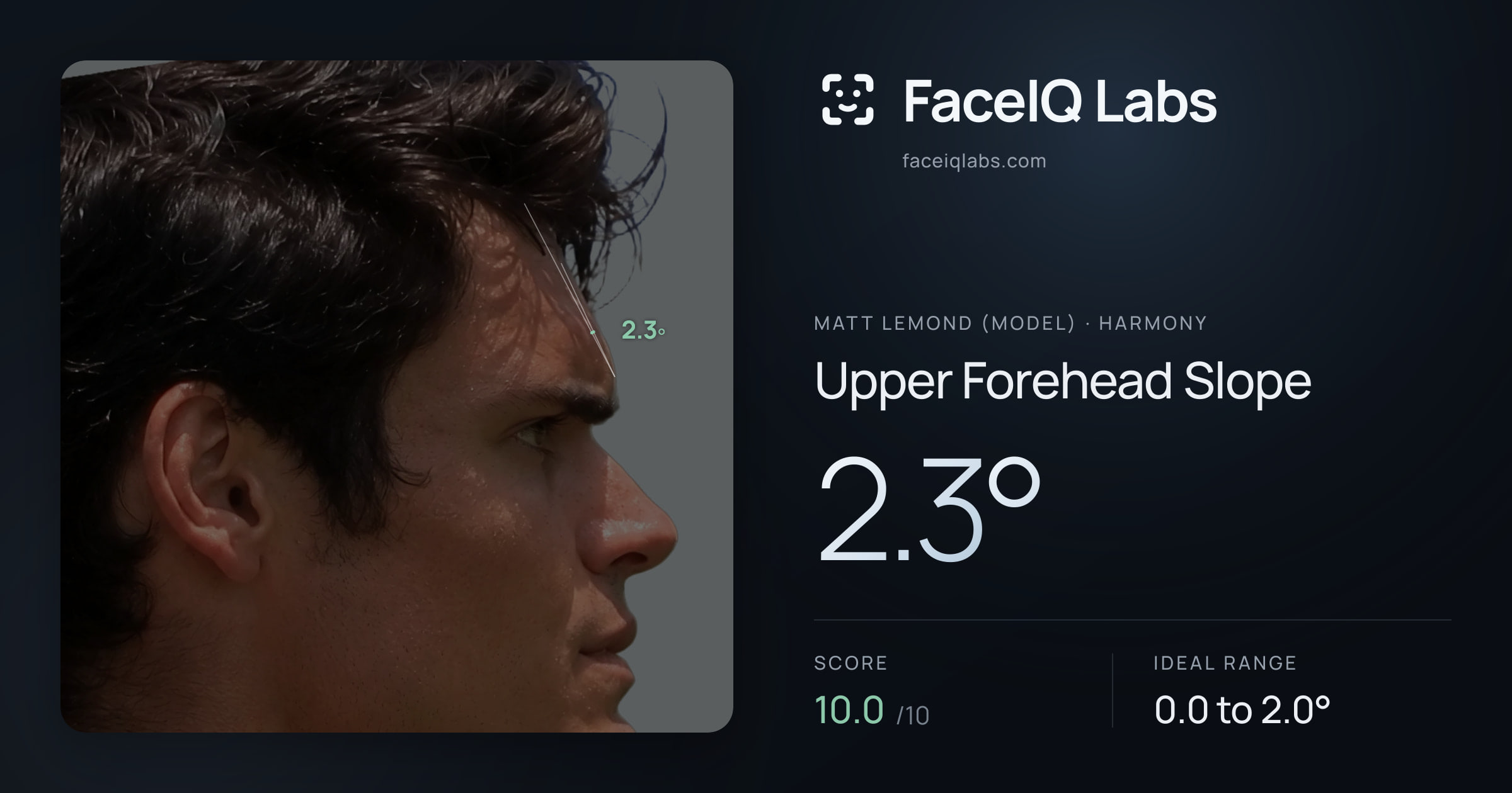 Matt Lemond (Model) Upper Forehead Slope: 2.3°, drawn on the photo