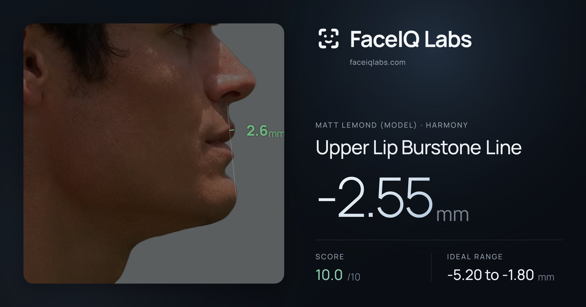Matt Lemond (Model) Upper Lip Burstone Line: -2.55mm, drawn on the photo