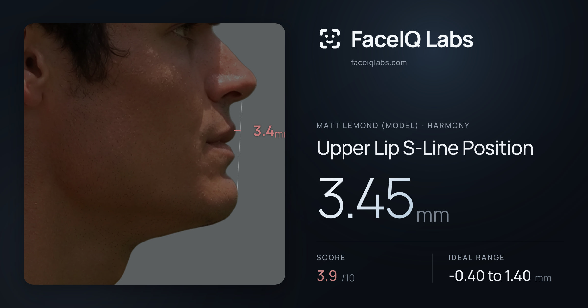 Matt Lemond (Model) Upper Lip S-Line Position: 3.45mm, drawn on the photo