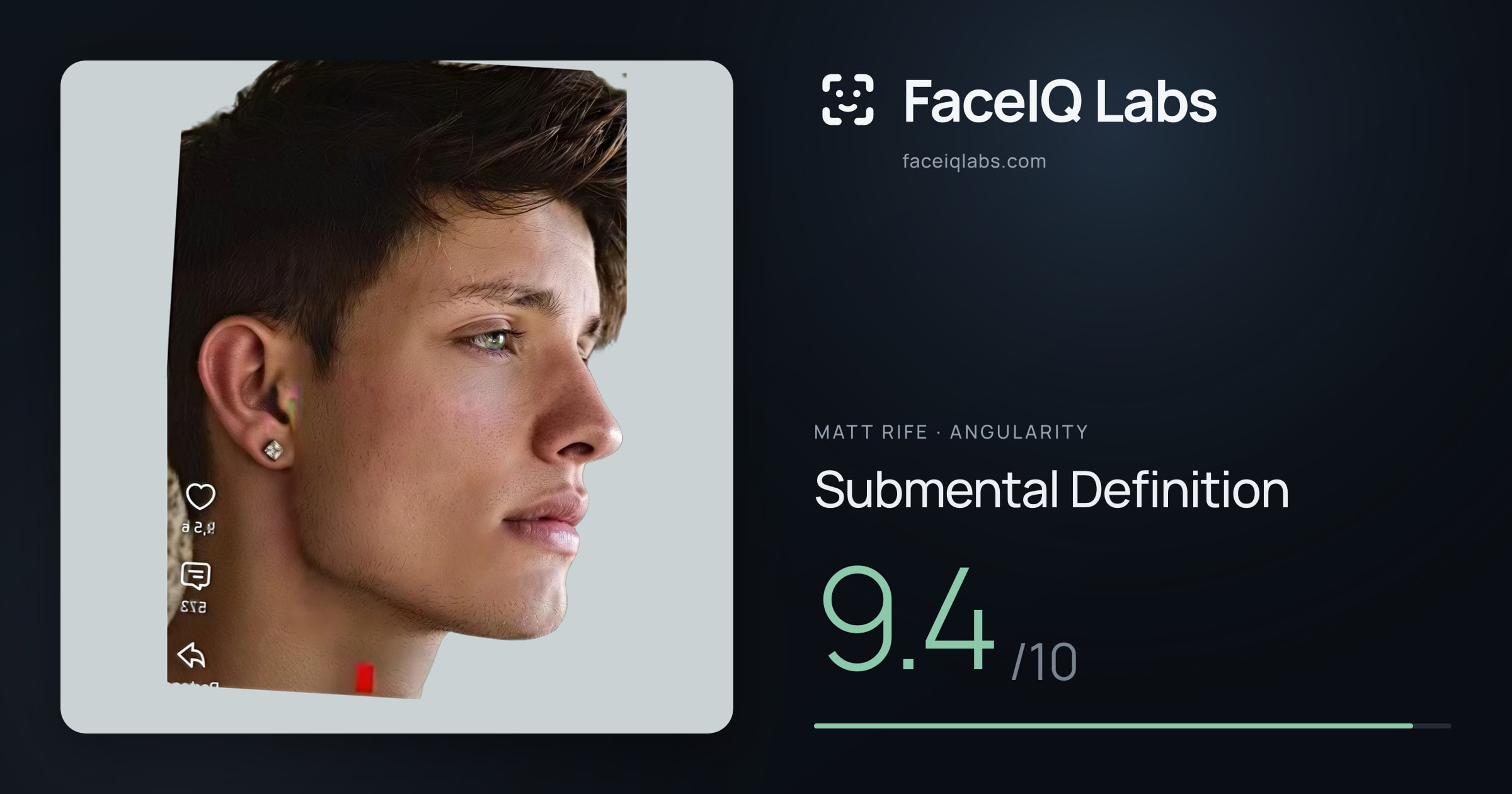 Matt Rife Submental Definition: 9.4/10, drawn on the photo