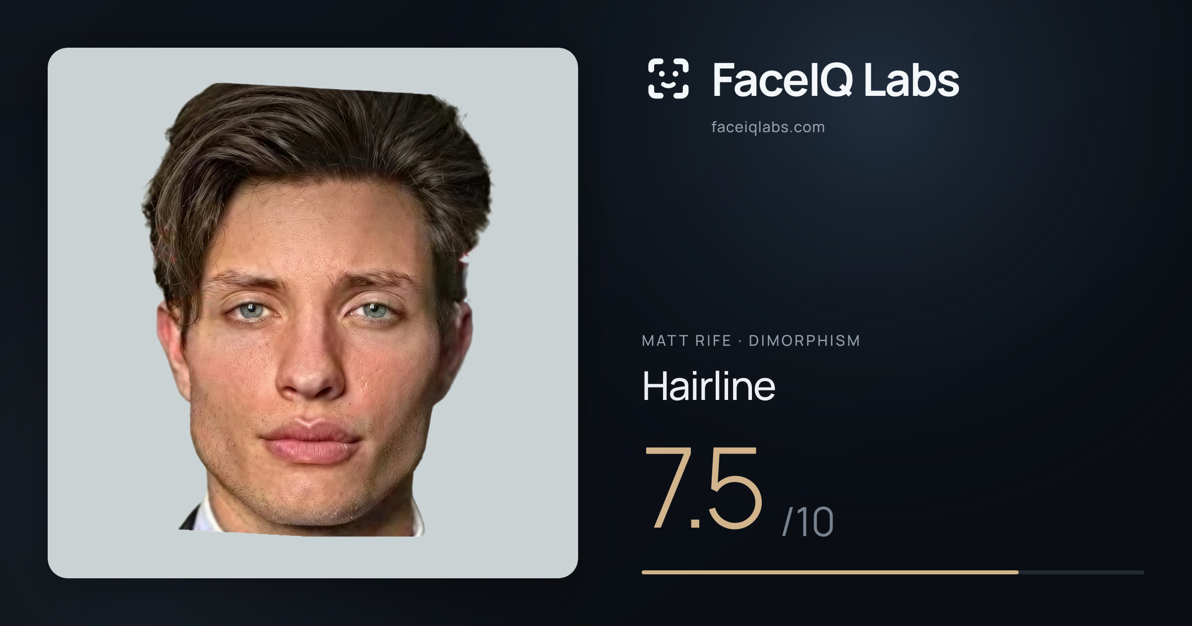 Matt Rife Hairline: 7.5/10, drawn on the photo