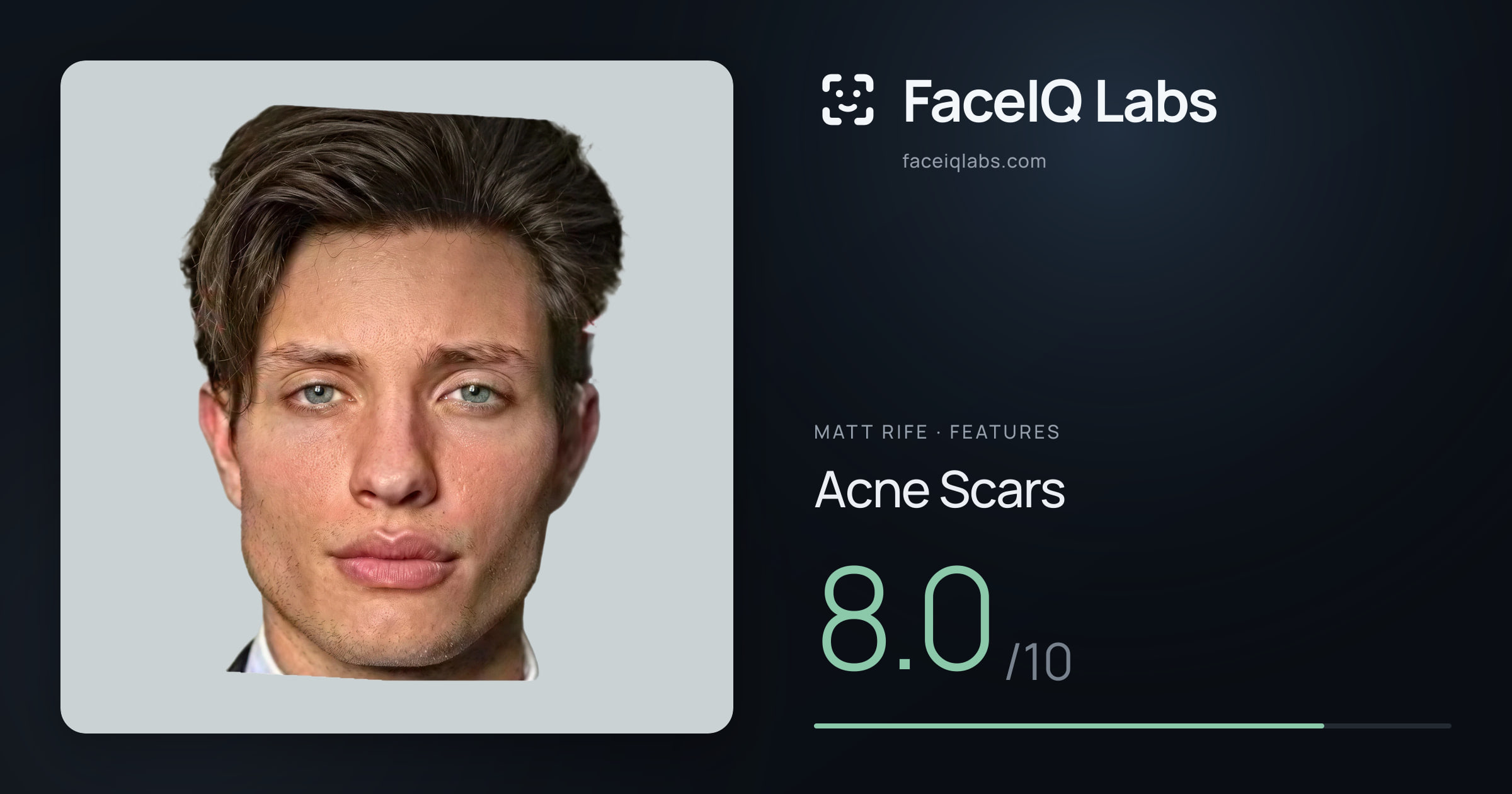 Matt Rife Acne Scars: 8.0/10, drawn on the photo