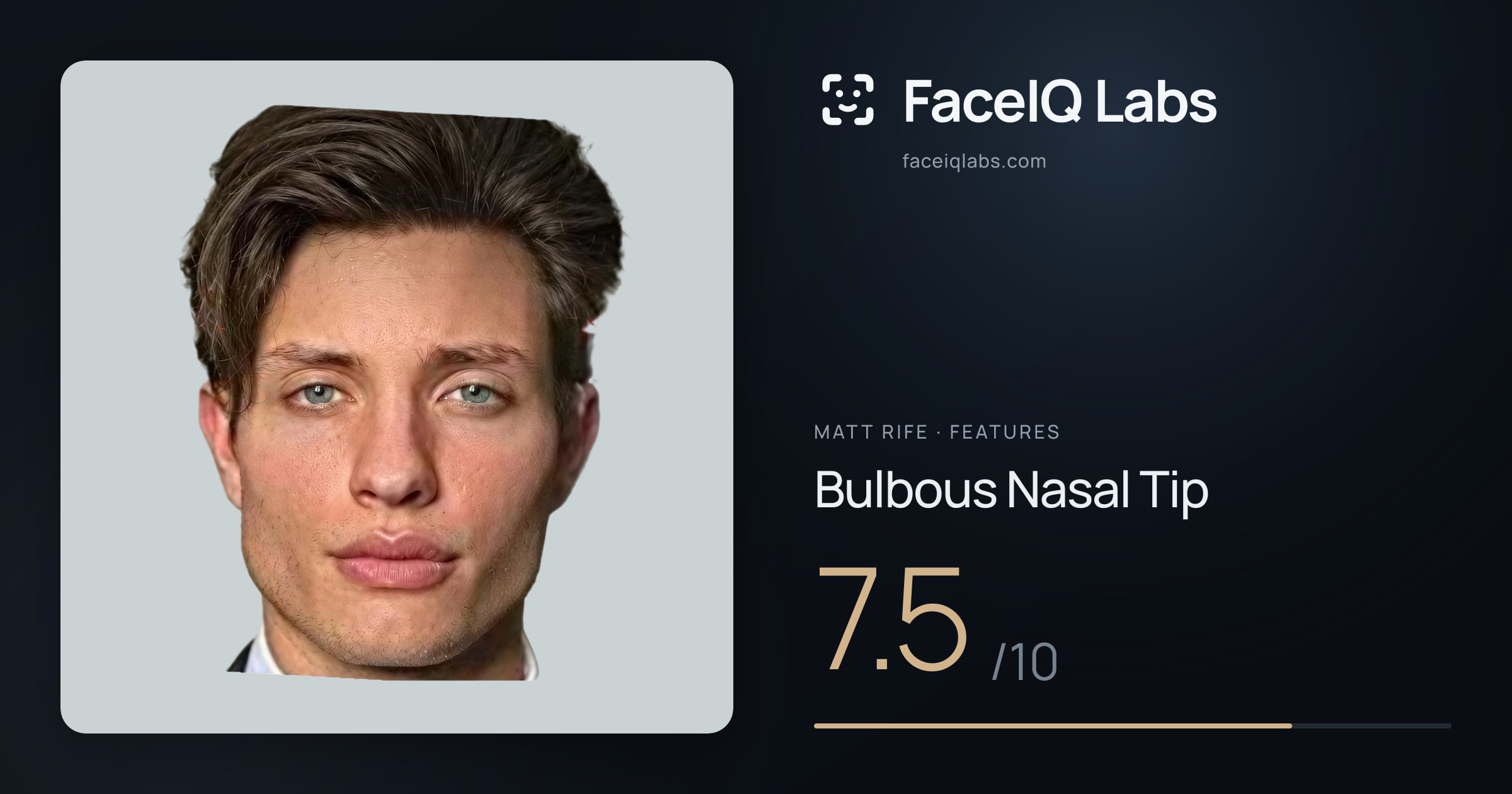 Matt Rife Bulbous Nasal Tip: 7.5/10, drawn on the photo