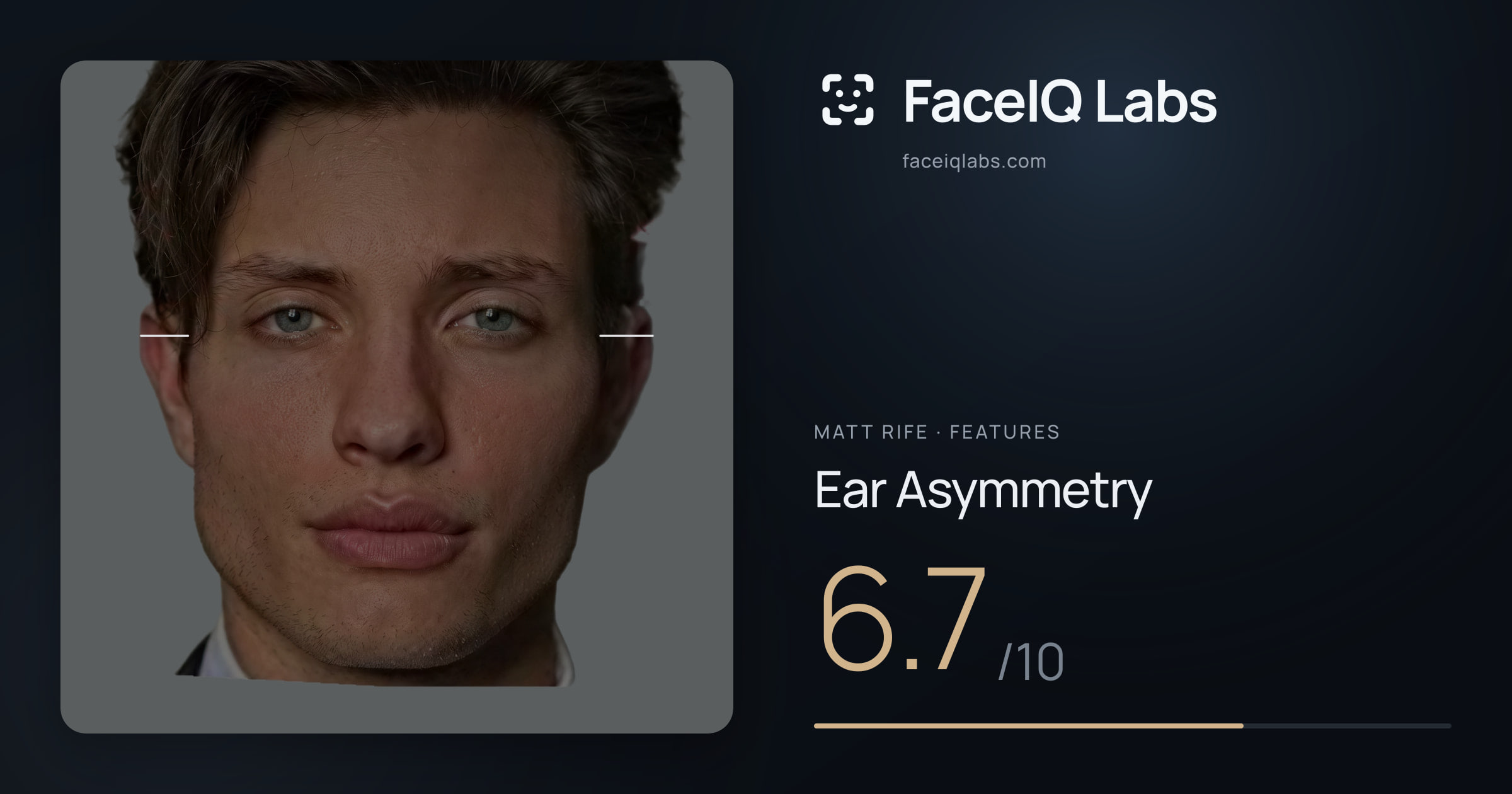 Matt Rife Ear Asymmetry: 6.7/10, drawn on the photo