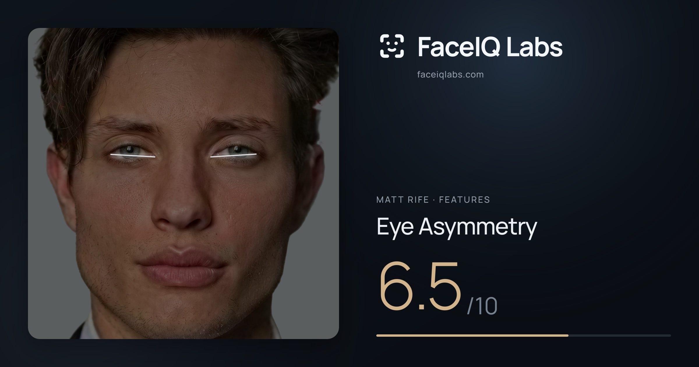 Matt Rife Eye Asymmetry: 6.5/10, drawn on the photo