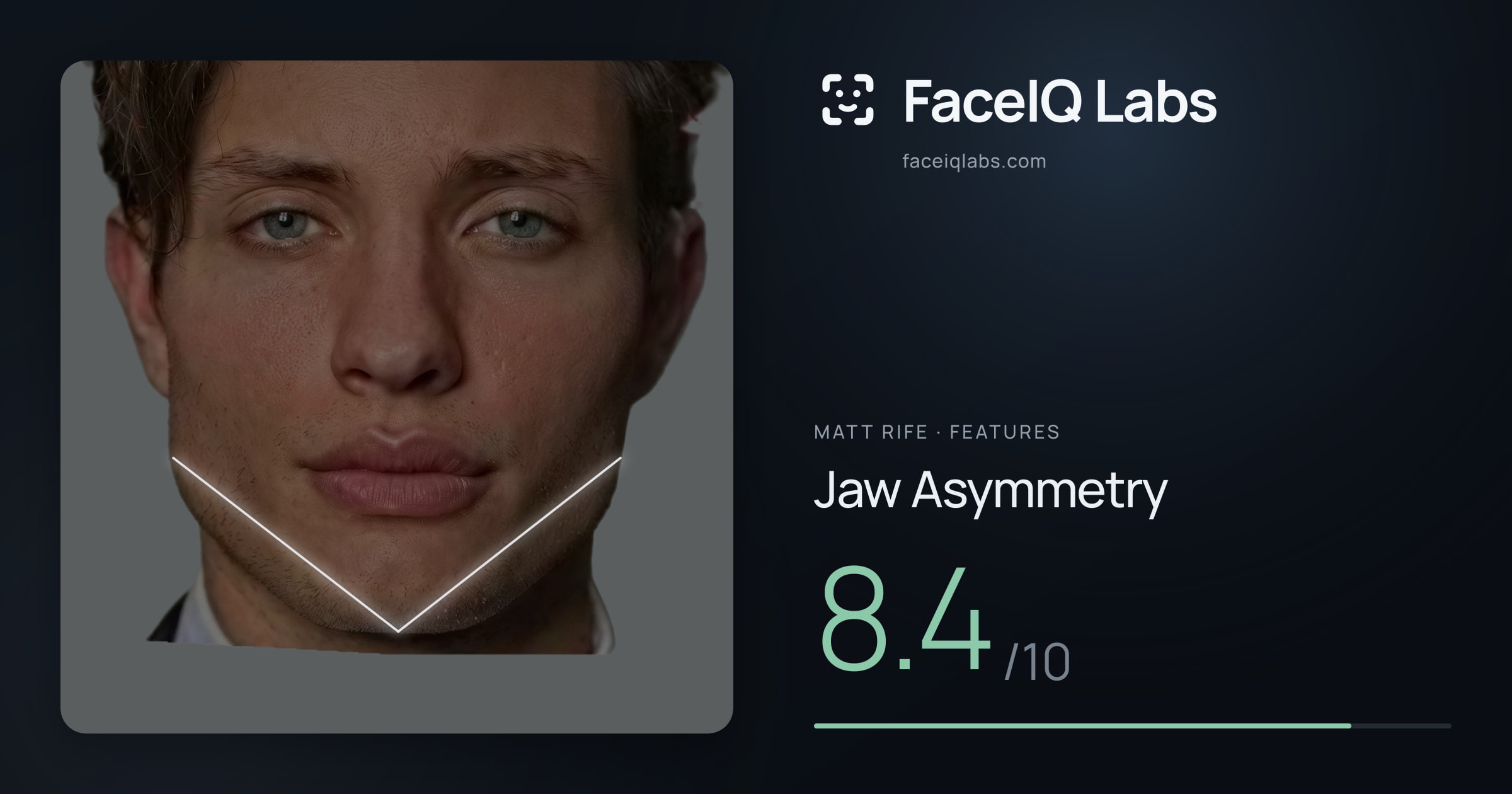 Matt Rife Jaw Asymmetry: 8.4/10, drawn on the photo