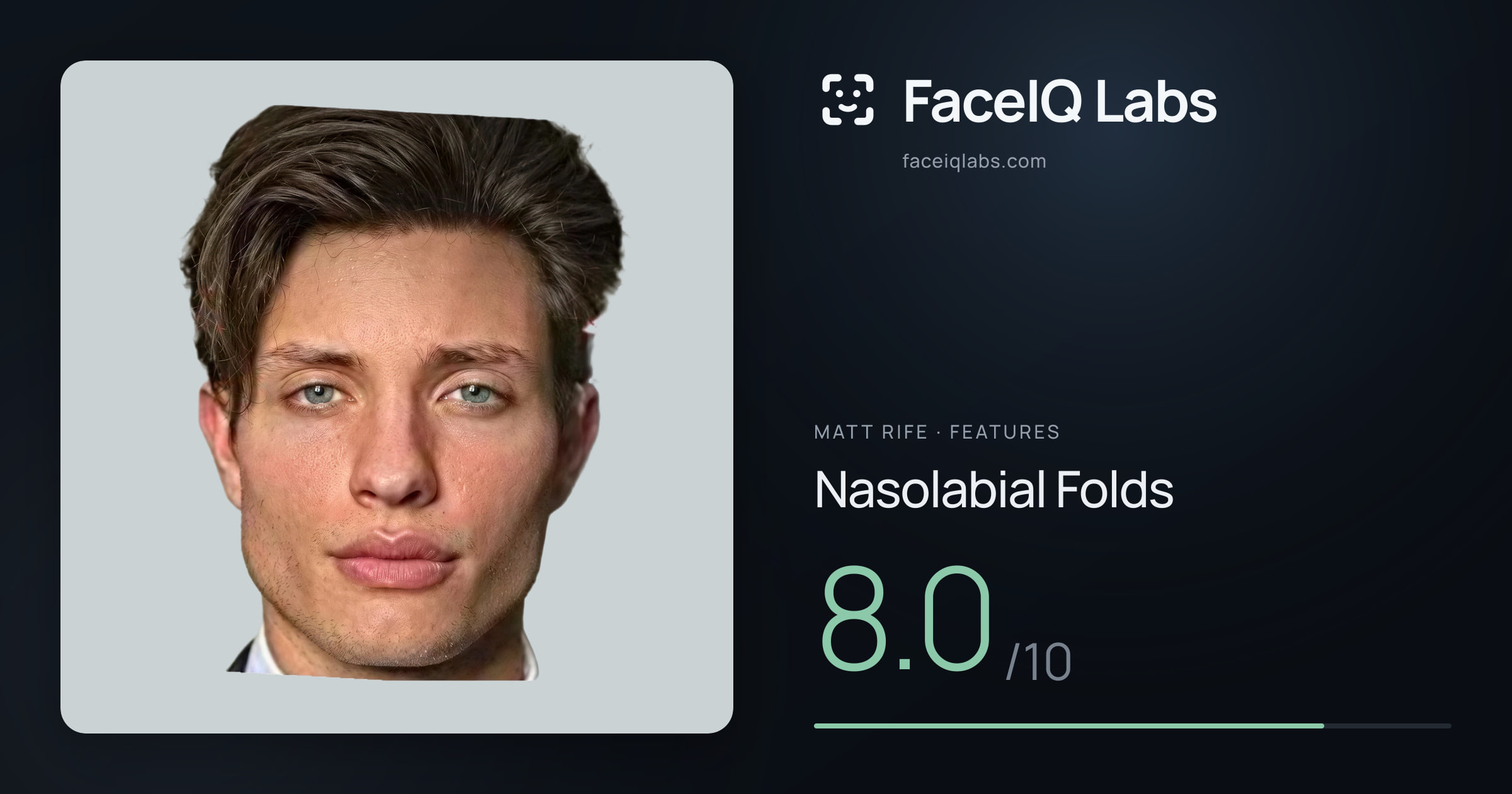 Matt Rife Nasolabial Folds: 8.0/10, drawn on the photo