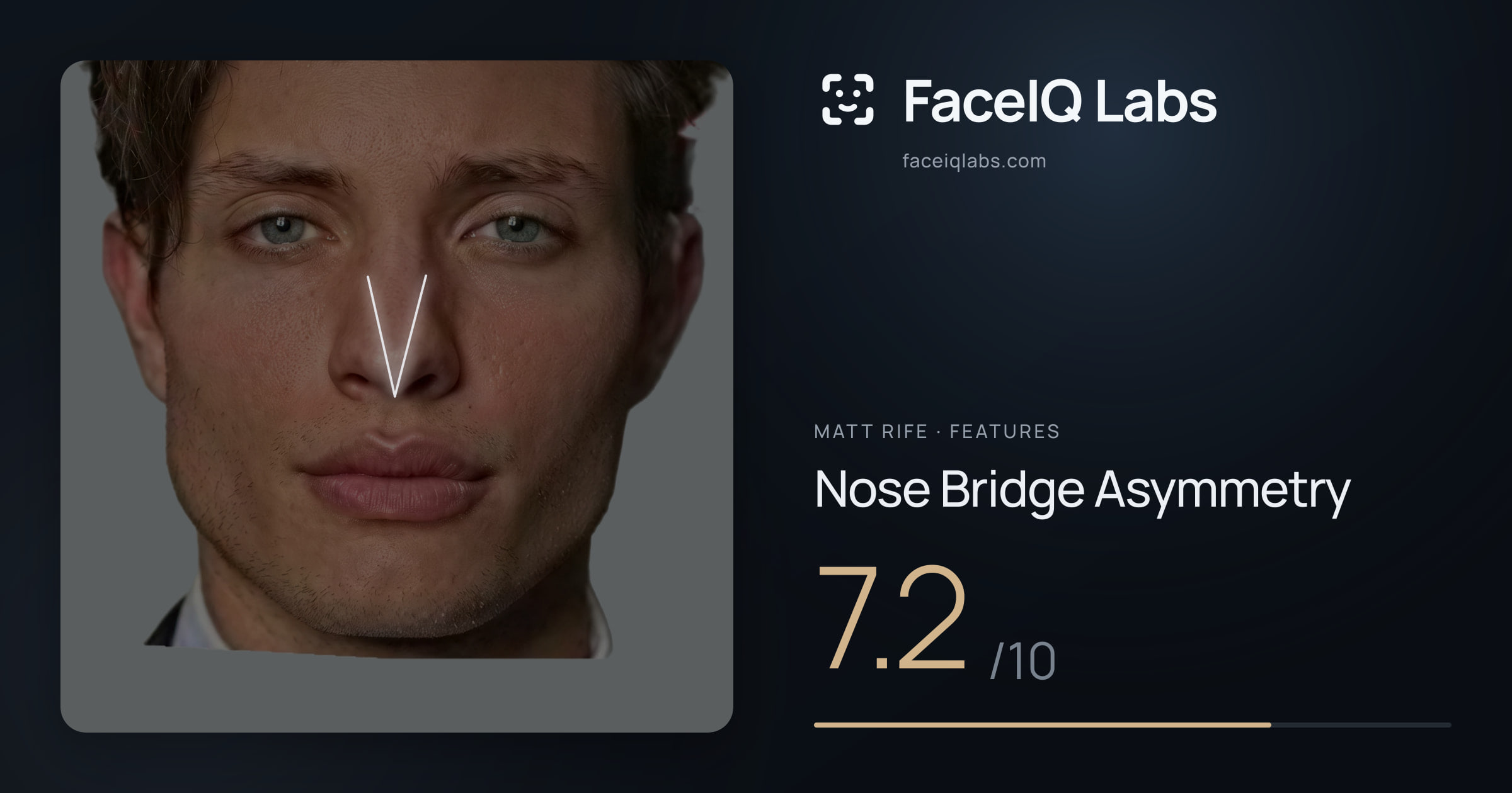 Matt Rife Nose Bridge Asymmetry: 7.2/10, drawn on the photo