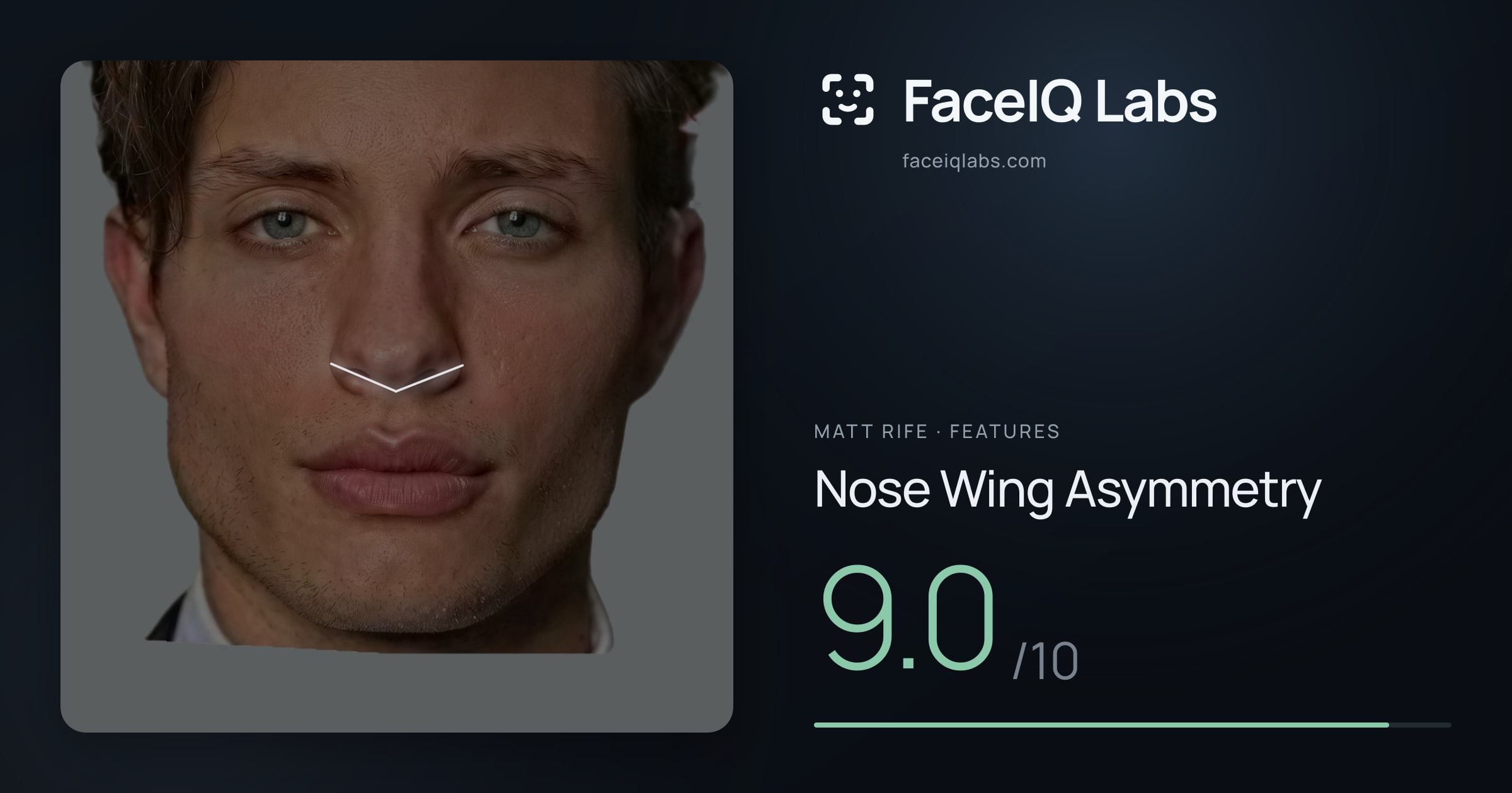 Matt Rife Nose Wing Asymmetry: 9.0/10, drawn on the photo