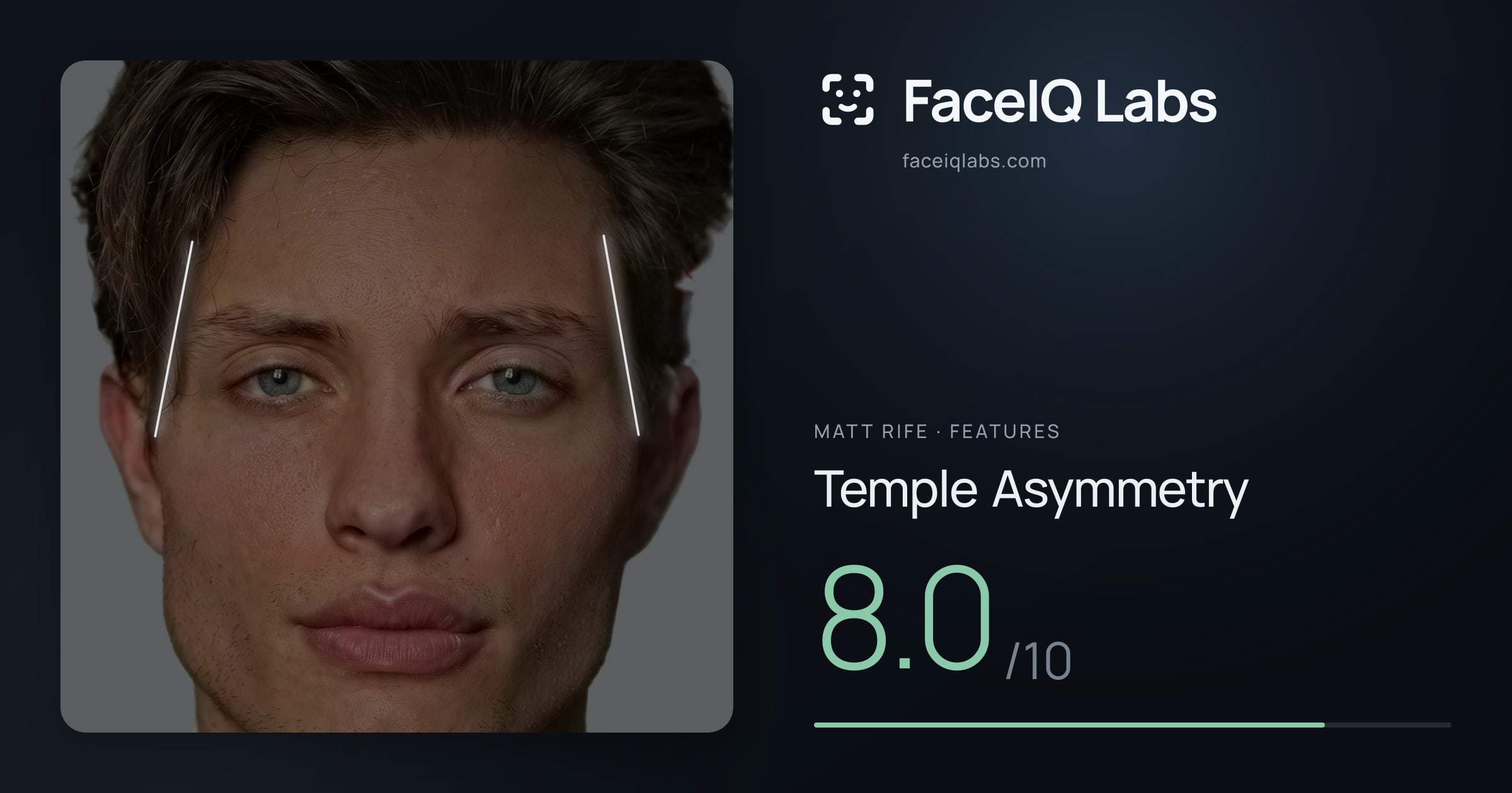 Matt Rife Temple Asymmetry: 8.0/10, drawn on the photo