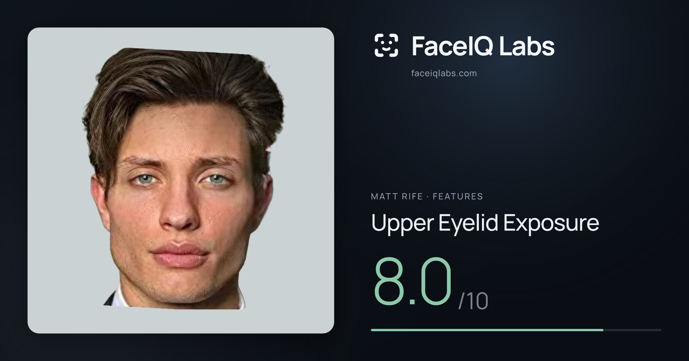 Matt Rife Upper Eyelid Exposure: 8.0/10, drawn on the photo
