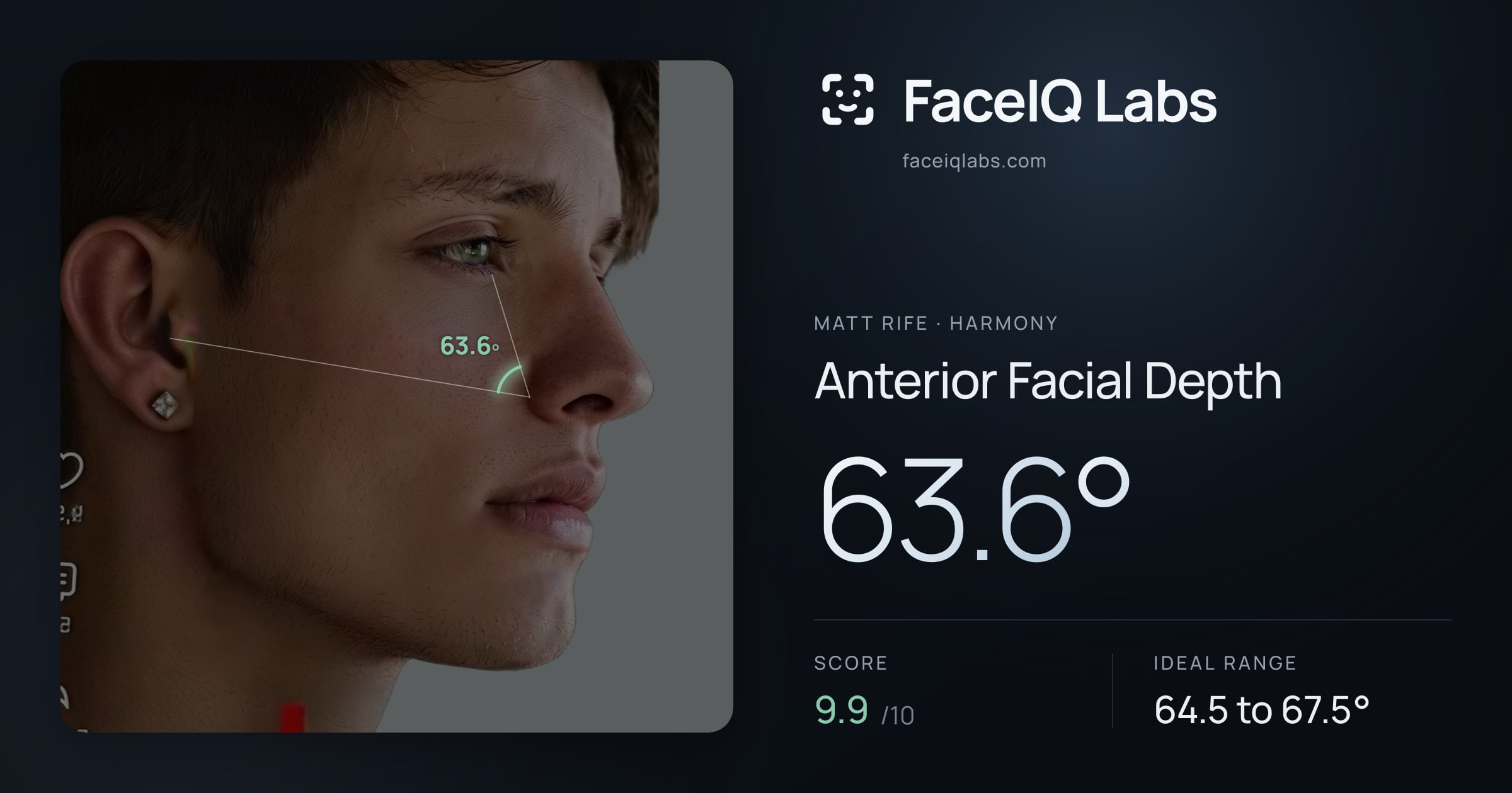 Matt Rife Anterior Facial Depth: 63.6°, drawn on the photo